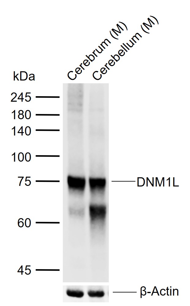 Lane 1: Mouse Cerebrum tissue lysates; Lane 2: Mouse Cerebellum tissue lysates probed with DNM1L/DLP1 Polyclonal Antibody, Unconjugated (bs-4100R) at 1:1000 dilution and 4°C overnight incubation. Followed by conjugated secondary antibody incubation at 1:20000 for 60 min at 37˚C.
