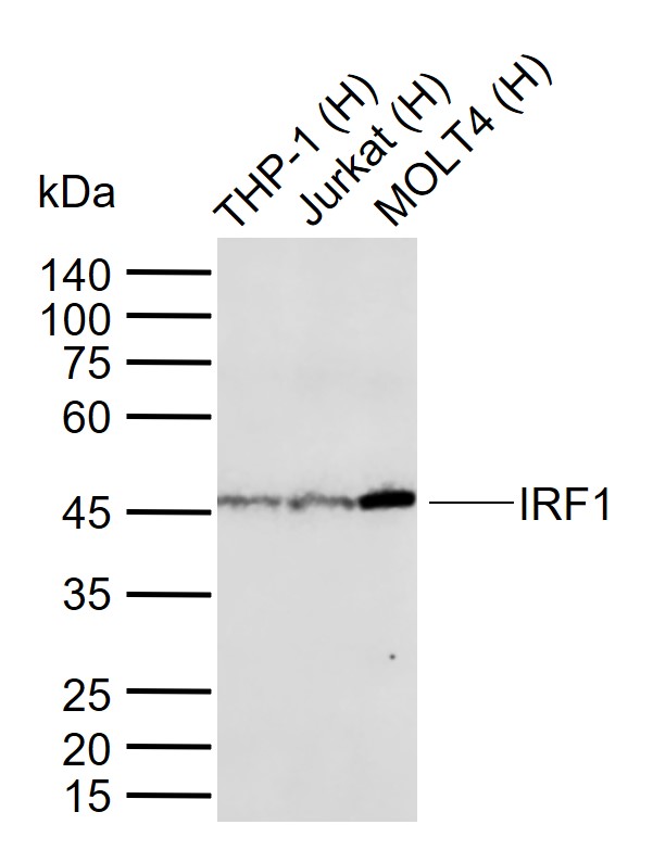 Lane 1: Human THP-1 cell lysates; Lane 2: Human Jurkat cell lysates; Lane 3: Human MOLT4 cell lysates probed with IRF1 Monoclonal Antibody, Unconjugated (bsm-52114R) at 1:1000 dilution and 4°C overnight incubation. Followed by conjugated secondary antibody incubation at 1:20000 for 60 min at 37˚C.