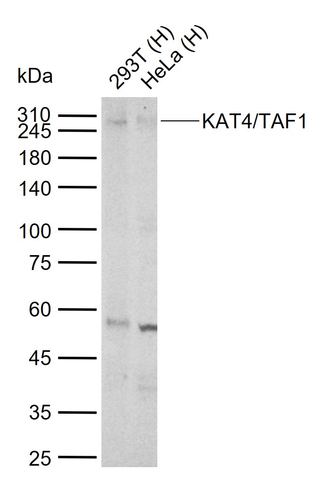 Lane 1: Human 293T cell lysates; Lane 2: Human HeLa cell lysates probed with KAT4/TAF1 Polyclonal Antibody, Unconjugated (bs-2812R) at 1:1000 dilution and 4°C overnight incubation. Followed by conjugated secondary antibody incubation at 1:20000 for 60 min at 37˚C.