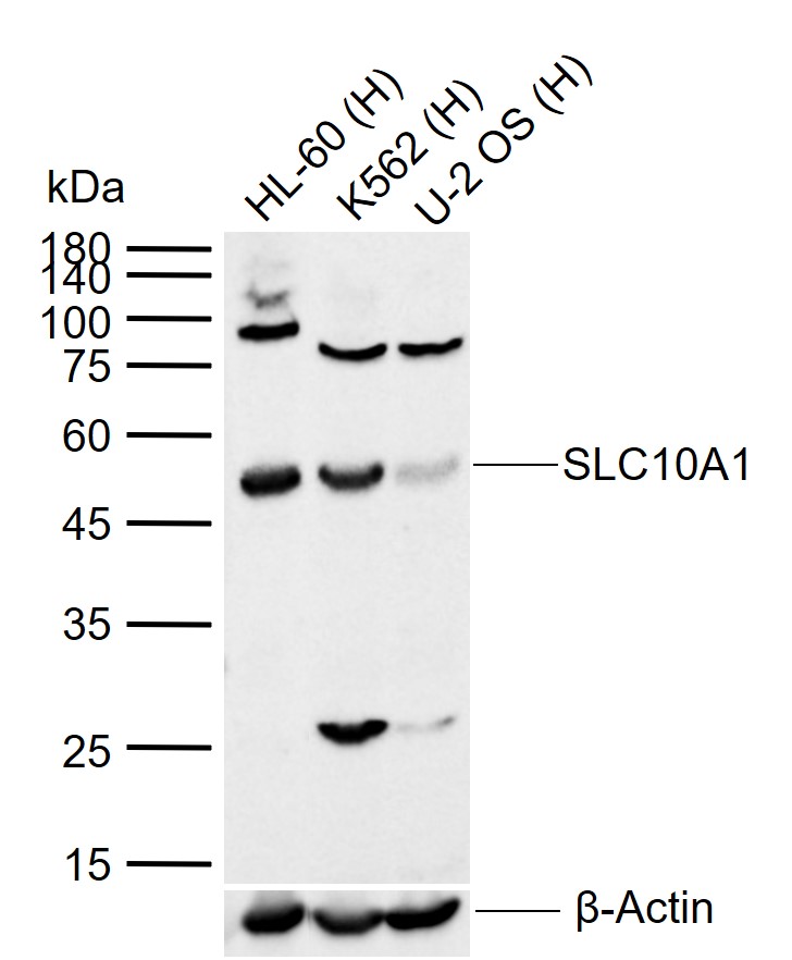 Lane 1: Human HL60 cell lysates; Lane 2: Human K562 cell lysates; Lane 3: Human U-2 OS cell lysates probed with SLC10A1 Polyclonal Antibody, Unconjugated (bs-1958R) at 1:1000 dilution and 4°C overnight incubation. Followed by conjugated secondary antibody incubation at 1:20000 for 60 min at 37˚C.