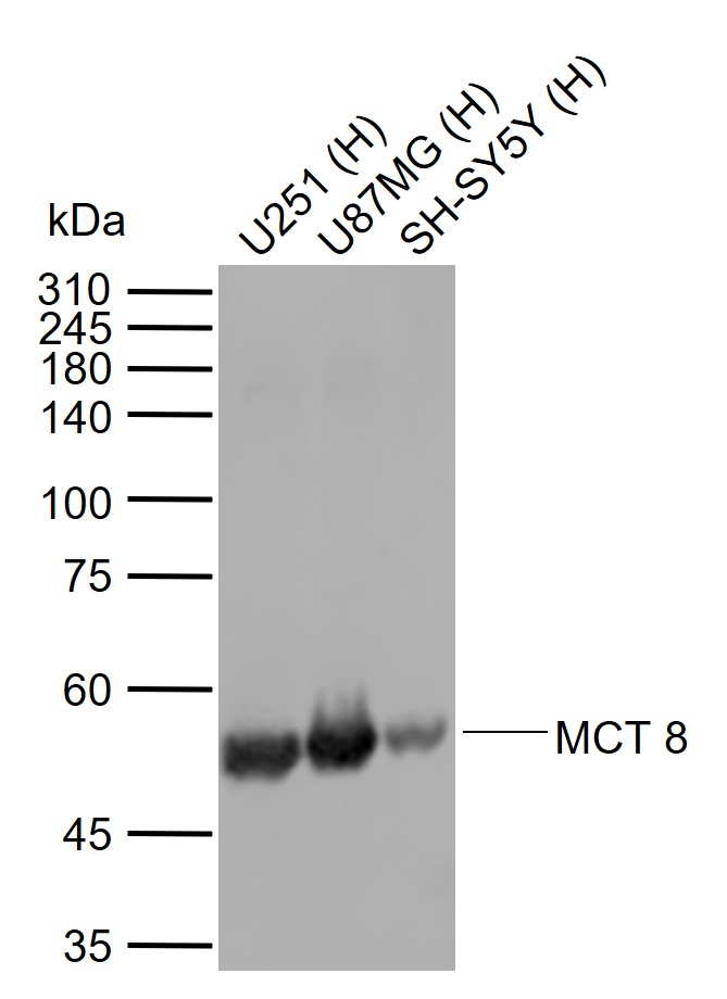 Lane 1: Human U251 cell lysates; Lane 2: Human U87MG cell lysates; Lane 3: Human SH-SY5Y cell lysates probed with MCT 8 Polyclonal Antibody, Unconjugated (bs-11434R) at 1:1000 dilution and 4°C overnight incubation. Followed by conjugated secondary antibody incubation at 1:20000 for 60 min at 37˚C.