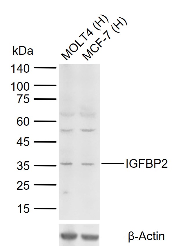 Lane 1: Human MOLT4 cell lysates; Lane 2: Human MCF-7 cell lysates probed with IGFBP2 Polyclonal Antibody, Unconjugated (bs-1108R) at 1:1000 dilution and 4\u00b0C overnight incubation. Followed by conjugated secondary antibody incubation at 1:20000 for 60 min at 37˚C.