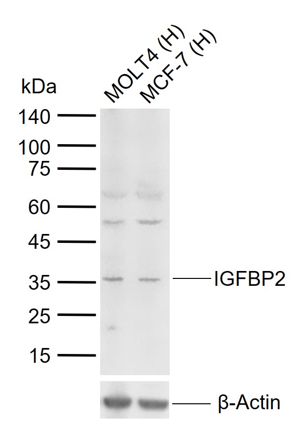 Lane 1: Human MOLT4 cell lysates; Lane 2: Human MCF-7 cell lysates probed with IGFBP2 Polyclonal Antibody, Unconjugated (bs-1108R) at 1:1000 dilution and 4°C overnight incubation. Followed by conjugated secondary antibody incubation at 1:20000 for 60 min at 37˚C.