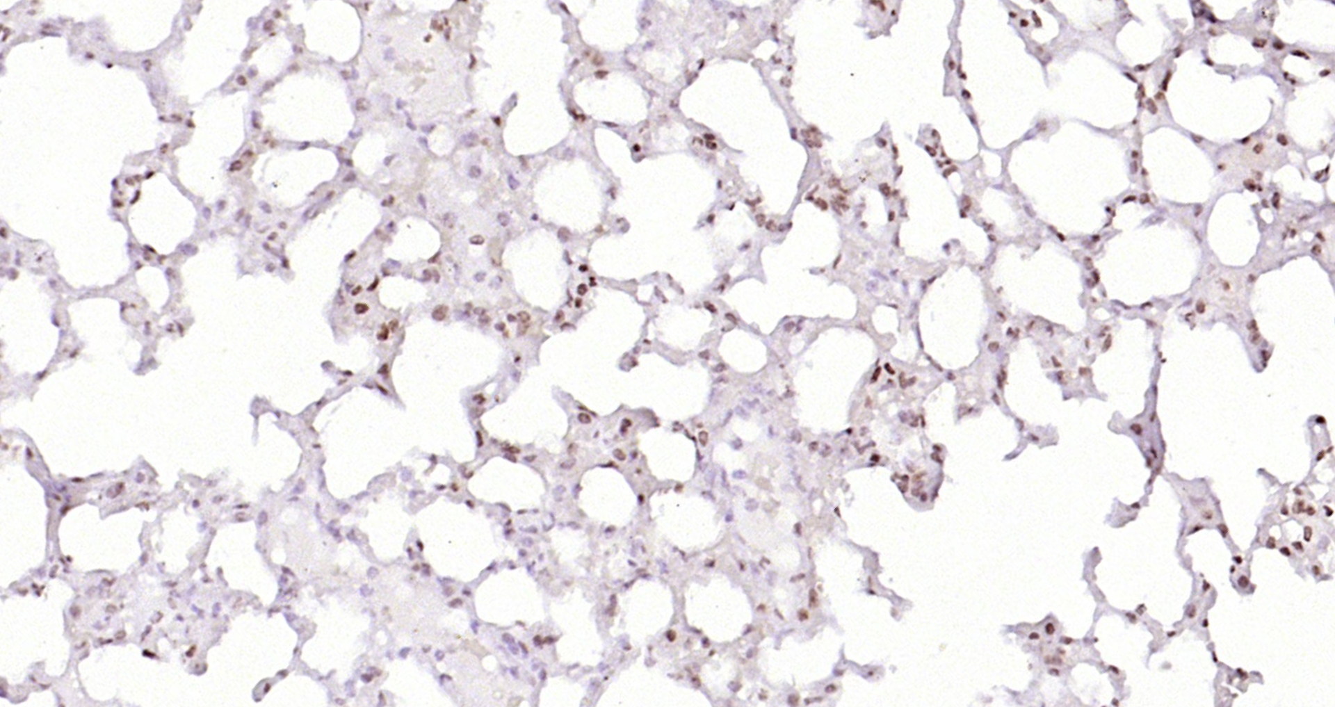Paraformaldehyde-fixed, paraffin embedded (mouse lung); Antigen retrieval by boiling in sodium citrate buffer (pH6.0) for 15min; Block endogenous peroxidase by 3% hydrogen peroxide for 20 minutes; Blocking buffer (normal goat serum) at 37°C for 30min; Antibody incubation with (Histone H4 (Acetyl K12)) Polyclonal Antibody, Unconjugated (bs-3746R) at 1:200 overnight at 4°C, followed by operating according to SP Kit(Rabbit) (sp-0023) instructionsand DAB staining. Paraformaldehyde-fixed, paraffin embedded (mouse lung); Antigen retrieval by boiling in sodium citrate buffer (pH6.0) for 15min; Block endogenous peroxidase by 3% hydrogen peroxide for 20 minutes; Blocking buffer (normal goat serum) at 37°C for 30min; Antibody incubation with (Histone H4 (Acetyl K12)) Polyclonal Antibody, Unconjugated (bs-3746R) at 1:200 overnight at 4°C, followed by operating according to SP Kit(Rabbit) (sp-0023) instructionsand DAB staining.