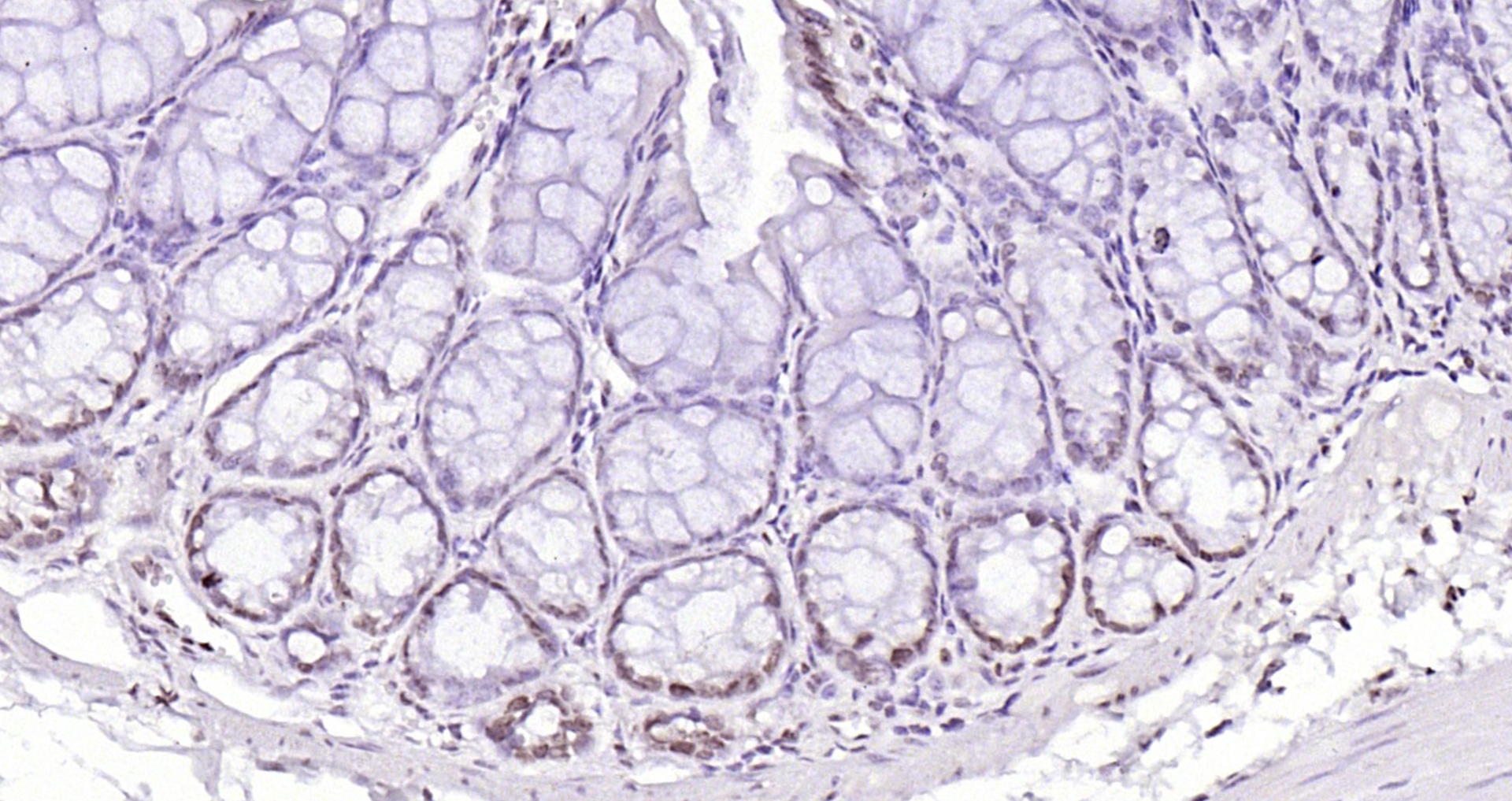 Paraformaldehyde-fixed, paraffin embedded (mouse colon); Antigen retrieval by boiling in sodium citrate buffer (pH6.0) for 15min; Block endogenous peroxidase by 3% hydrogen peroxide for 20 minutes; Blocking buffer (normal goat serum) at 37°C for 30min; Antibody incubation with (Histone H4 (Acetyl K12)) Polyclonal Antibody, Unconjugated (bs-3746R) at 1:200 overnight at 4°C, followed by operating according to SP Kit(Rabbit) (sp-0023) instructionsand DAB staining. Paraformaldehyde-fixed, paraffin embedded (mouse colon); Antigen retrieval by boiling in sodium citrate buffer (pH6.0) for 15min; Block endogenous peroxidase by 3% hydrogen peroxide for 20 minutes; Blocking buffer (normal goat serum) at 37°C for 30min; Antibody incubation with (Histone H4 (Acetyl K12)) Polyclonal Antibody, Unconjugated (bs-3746R) at 1:200 overnight at 4°C, followed by operating according to SP Kit(Rabbit) (sp-0023) instructionsand DAB staining.