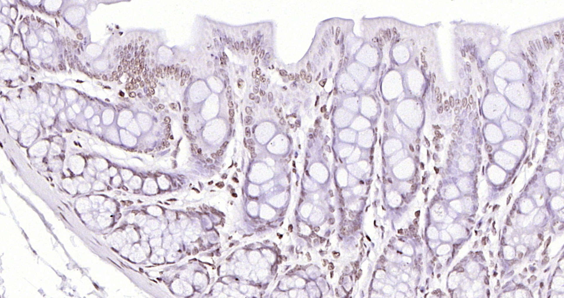 Paraformaldehyde-fixed, paraffin embedded (rat colon); Antigen retrieval by boiling in sodium citrate buffer (pH6.0) for 15min; Block endogenous peroxidase by 3% hydrogen peroxide for 20 minutes; Blocking buffer (normal goat serum) at 37°C for 30min; Antibody incubation with (Histone H4 (Acetyl K12)) Polyclonal Antibody, Unconjugated (bs-3746R) at 1:200 overnight at 4°C, followed by operating according to SP Kit(Rabbit) (sp-0023) instructionsand DAB staining. Paraformaldehyde-fixed, paraffin embedded (rat colon); Antigen retrieval by boiling in sodium citrate buffer (pH6.0) for 15min; Block endogenous peroxidase by 3% hydrogen peroxide for 20 minutes; Blocking buffer (normal goat serum) at 37°C for 30min; Antibody incubation with (Histone H4 (Acetyl K12)) Polyclonal Antibody, Unconjugated (bs-3746R) at 1:200 overnight at 4°C, followed by operating according to SP Kit(Rabbit) (sp-0023) instructionsand DAB staining.