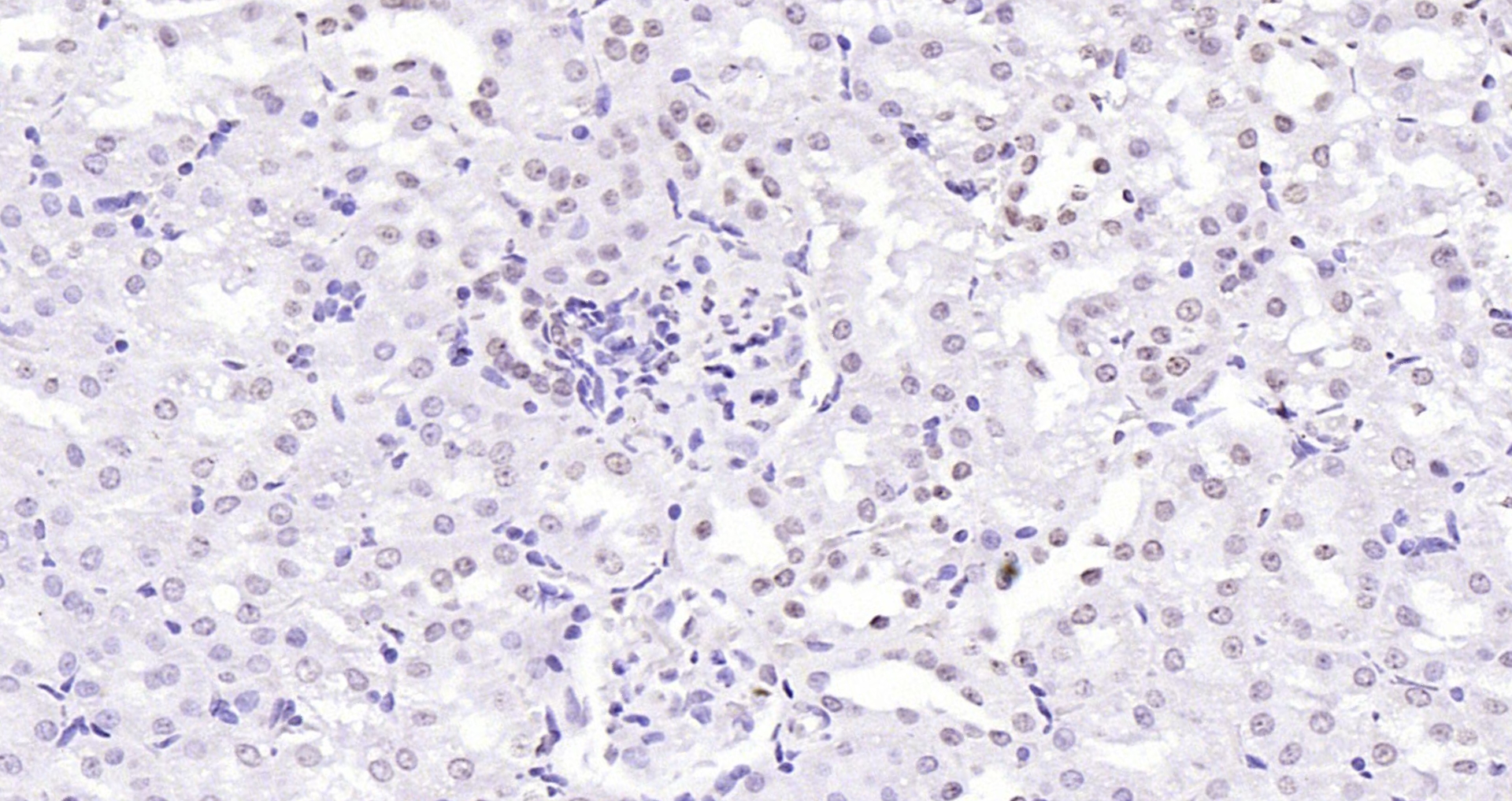 Paraformaldehyde-fixed, paraffin embedded (rat kidney); Antigen retrieval by boiling in sodium citrate buffer (pH6.0) for 15min; Block endogenous peroxidase by 3% hydrogen peroxide for 20 minutes; Blocking buffer (normal goat serum) at 37°C for 30min; Antibody incubation with (Histone H4 (Acetyl K12)) Polyclonal Antibody, Unconjugated (bs-3746R) at 1:200 overnight at 4°C, followed by operating according to SP Kit(Rabbit) (sp-0023) instructionsand DAB staining. Paraformaldehyde-fixed, paraffin embedded (rat kidney); Antigen retrieval by boiling in sodium citrate buffer (pH6.0) for 15min; Block endogenous peroxidase by 3% hydrogen peroxide for 20 minutes; Blocking buffer (normal goat serum) at 37°C for 30min; Antibody incubation with (Histone H4 (Acetyl K12)) Polyclonal Antibody, Unconjugated (bs-3746R) at 1:200 overnight at 4°C, followed by operating according to SP Kit(Rabbit) (sp-0023) instructionsand DAB staining.