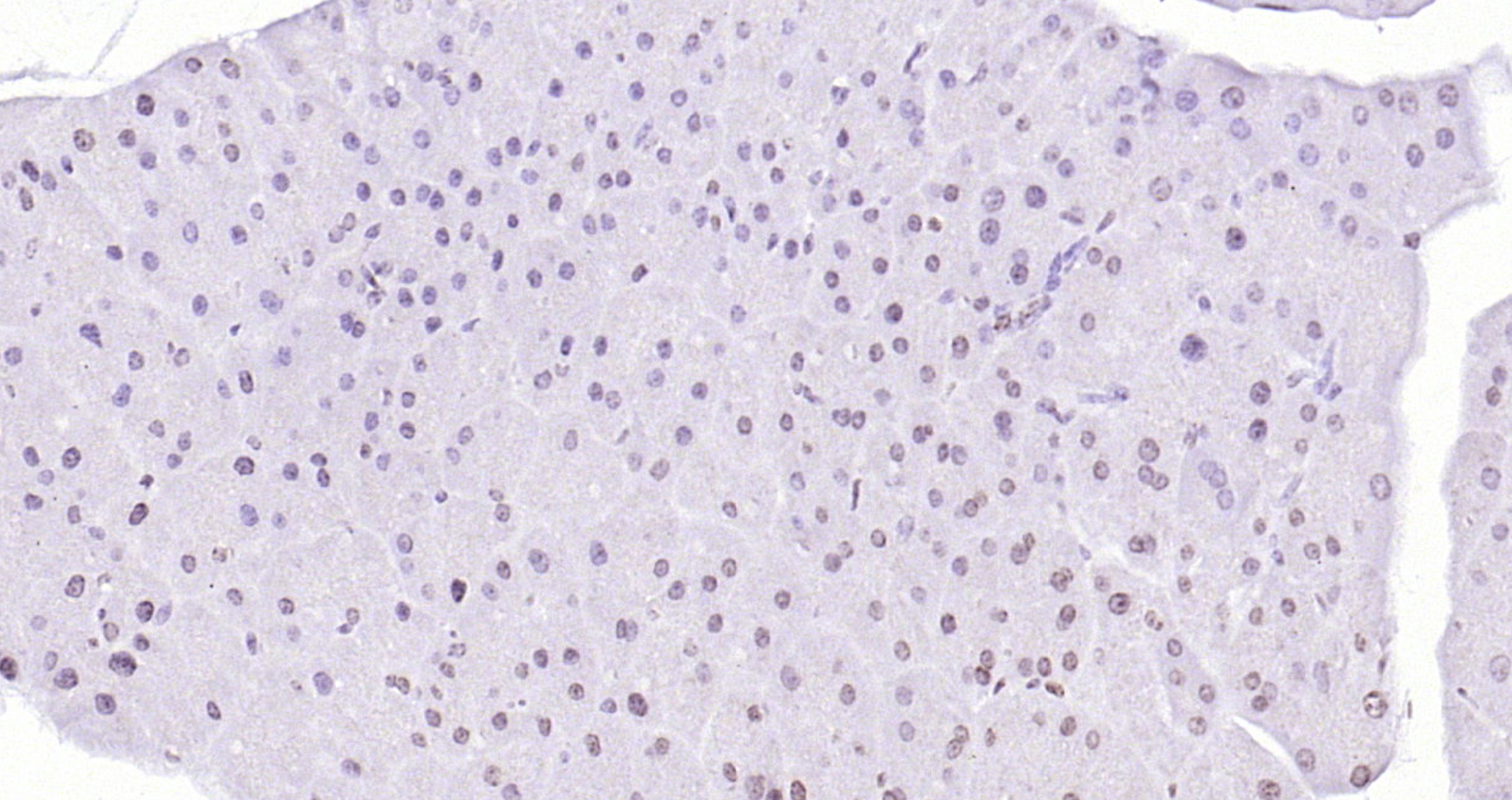 Paraformaldehyde-fixed, paraffin embedded (rat pancreas); Antigen retrieval by boiling in sodium citrate buffer (pH6.0) for 15min; Block endogenous peroxidase by 3% hydrogen peroxide for 20 minutes; Blocking buffer (normal goat serum) at 37°C for 30min; Antibody incubation with (Histone H4 (Acetyl K12)) Polyclonal Antibody, Unconjugated (bs-3746R) at 1:200 overnight at 4°C, followed by operating according to SP Kit(Rabbit) (sp-0023) instructionsand DAB staining. Paraformaldehyde-fixed, paraffin embedded (rat pancreas); Antigen retrieval by boiling in sodium citrate buffer (pH6.0) for 15min; Block endogenous peroxidase by 3% hydrogen peroxide for 20 minutes; Blocking buffer (normal goat serum) at 37°C for 30min; Antibody incubation with (Histone H4 (Acetyl K12)) Polyclonal Antibody, Unconjugated (bs-3746R) at 1:200 overnight at 4°C, followed by operating according to SP Kit(Rabbit) (sp-0023) instructionsand DAB staining.