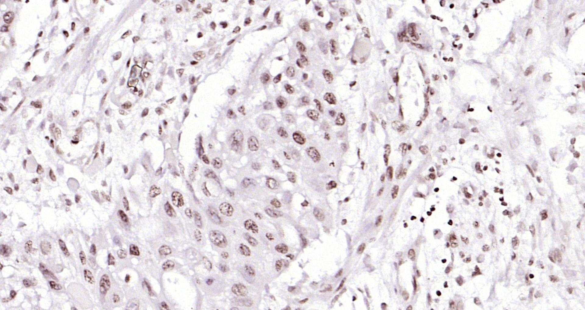 Paraformaldehyde-fixed, paraffin embedded (human colon carcinoma); Antigen retrieval by boiling in sodium citrate buffer (pH6.0) for 15min; Block endogenous peroxidase by 3% hydrogen peroxide for 20 minutes; Blocking buffer (normal goat serum) at 37°C for 30min; Antibody incubation with (Histone H4 (Acetyl K12)) Polyclonal Antibody, Unconjugated (bs-3746R) at 1:200 overnight at 4°C, followed by operating according to SP Kit(Rabbit) (sp-0023) instructionsand DAB staining. Paraformaldehyde-fixed, paraffin embedded (human colon carcinoma); Antigen retrieval by boiling in sodium citrate buffer (pH6.0) for 15min; Block endogenous peroxidase by 3% hydrogen peroxide for 20 minutes; Blocking buffer (normal goat serum) at 37°C for 30min; Antibody incubation with (Histone H4 (Acetyl K12)) Polyclonal Antibody, Unconjugated (bs-3746R) at 1:200 overnight at 4°C, followed by operating according to SP Kit(Rabbit) (sp-0023) instructionsand DAB staining.