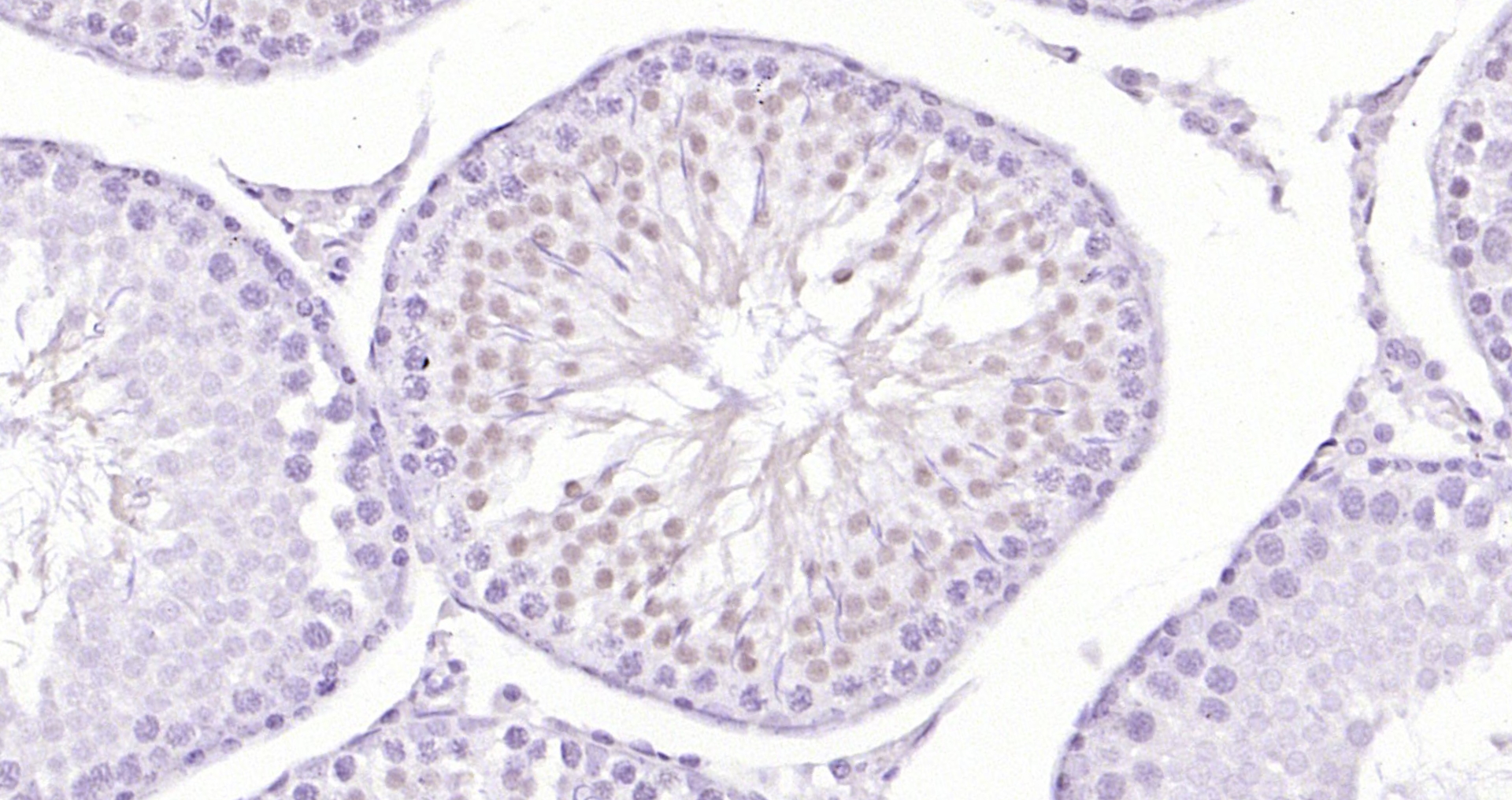 Paraformaldehyde-fixed, paraffin embedded (rat testis); Antigen retrieval by boiling in sodium citrate buffer (pH6.0) for 15min; Block endogenous peroxidase by 3% hydrogen peroxide for 20 minutes; Blocking buffer (normal goat serum) at 37°C for 30min; Antibody incubation with (HES5) Polyclonal Antibody, Unconjugated (bs-3767R) at 1:200 overnight at 4°C, followed by operating according to SP Kit(Rabbit) (sp-0023) instructionsand DAB staining.