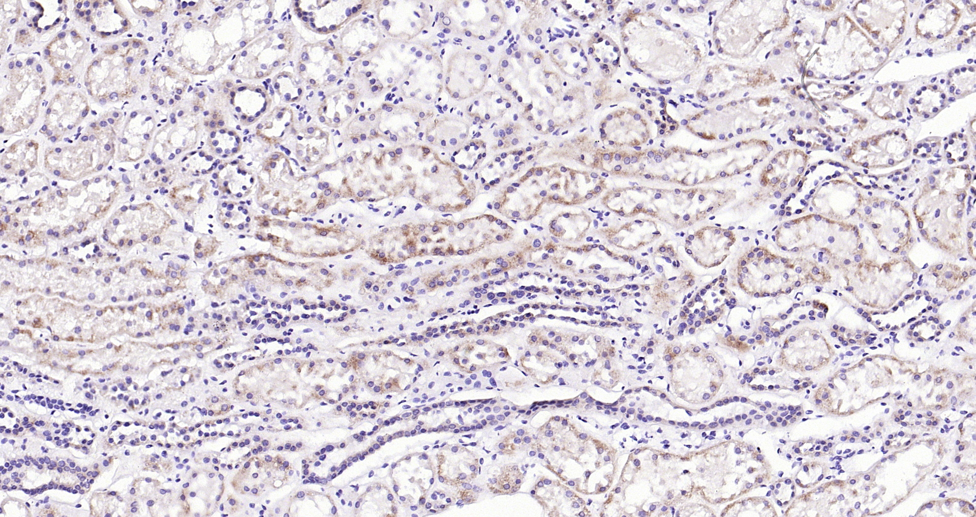 Paraformaldehyde-fixed, paraffin embedded (Human kidney); Antigen retrieval by boiling in sodium citrate buffer (pH6.0) for 15min; Block endogenous peroxidase by 3% hydrogen peroxide for 20 minutes; Blocking buffer (normal goat serum) at 37°C for 30min; Antibody incubation with (IGF2) Monoclonal Antibody, Unconjugated (bsm-52776R) at 1:200 overnight at 4°C, followed by operating according to SP Kit(Rabbit) (sp-0023) instructionsand DAB staining.