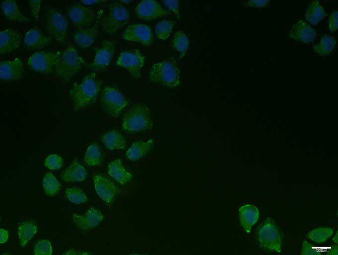 Hela cell; 4% Paraformaldehyde-fixed; Triton X-100 at room temperature for 20 min; Blocking buffer (normal goat serum, C-0005) at 37°C for 20 min; Antibody incubation with (PIEZO1) polyclonal Antibody, Unconjugated (bs-14991R) 1:100, 90 minutes at 37°C; followed by a conjugated Goat Anti-Rabbit IgG antibody at 37°C for 90 minutes, DAPI (blue, C02-04002) was used to stain the cell nuclei.