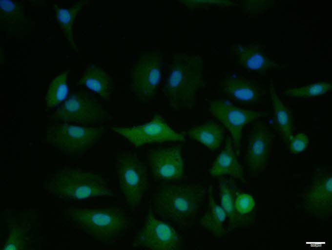 A549 cell; 4% Paraformaldehyde-fixed; Triton X-100 at room temperature for 20 min; Blocking buffer (normal goat serum, C-0005) at 37°C for 20 min; Antibody incubation with (VAX1) polyclonal Antibody, Unconjugated (bs-11496R) 1:100, 90 minutes at 37°C; followed by a conjugated Goat Anti-Rabbit IgG antibody at 37°C for 90 minutes, DAPI (blue, C02-04002) was used to stain the cell nuclei.