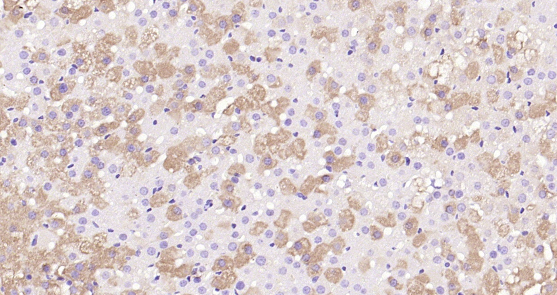 Paraformaldehyde-fixed, paraffin embedded (rat adrenal gland); Antigen retrieval by boiling in sodium citrate buffer (pH6.0) for 15min; Block endogenous peroxidase by 3% hydrogen peroxide for 20 minutes; Blocking buffer (normal goat serum) at 37°C for 30min; Antibody incubation with (CYP11A1) Polyclonal Antibody, Unconjugated (bs-3608R) at 1:200 overnight at 4°C, followed by operating according to SP Kit(Rabbit) (sp-0023) instructionsand DAB staining