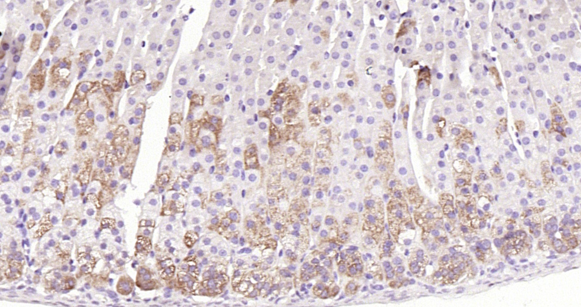 Paraformaldehyde-fixed, paraffin embedded (mouse adrenal gland); Antigen retrieval by boiling in sodium citrate buffer (pH6.0) for 15min; Block endogenous peroxidase by 3% hydrogen peroxide for 20 minutes; Blocking buffer (normal goat serum) at 37°C for 30min; Antibody incubation with (CYP11A1) Polyclonal Antibody, Unconjugated (bs-3608R) at 1:200 overnight at 4°C, followed by operating according to SP Kit(Rabbit) (sp-0023) instructionsand DAB staining