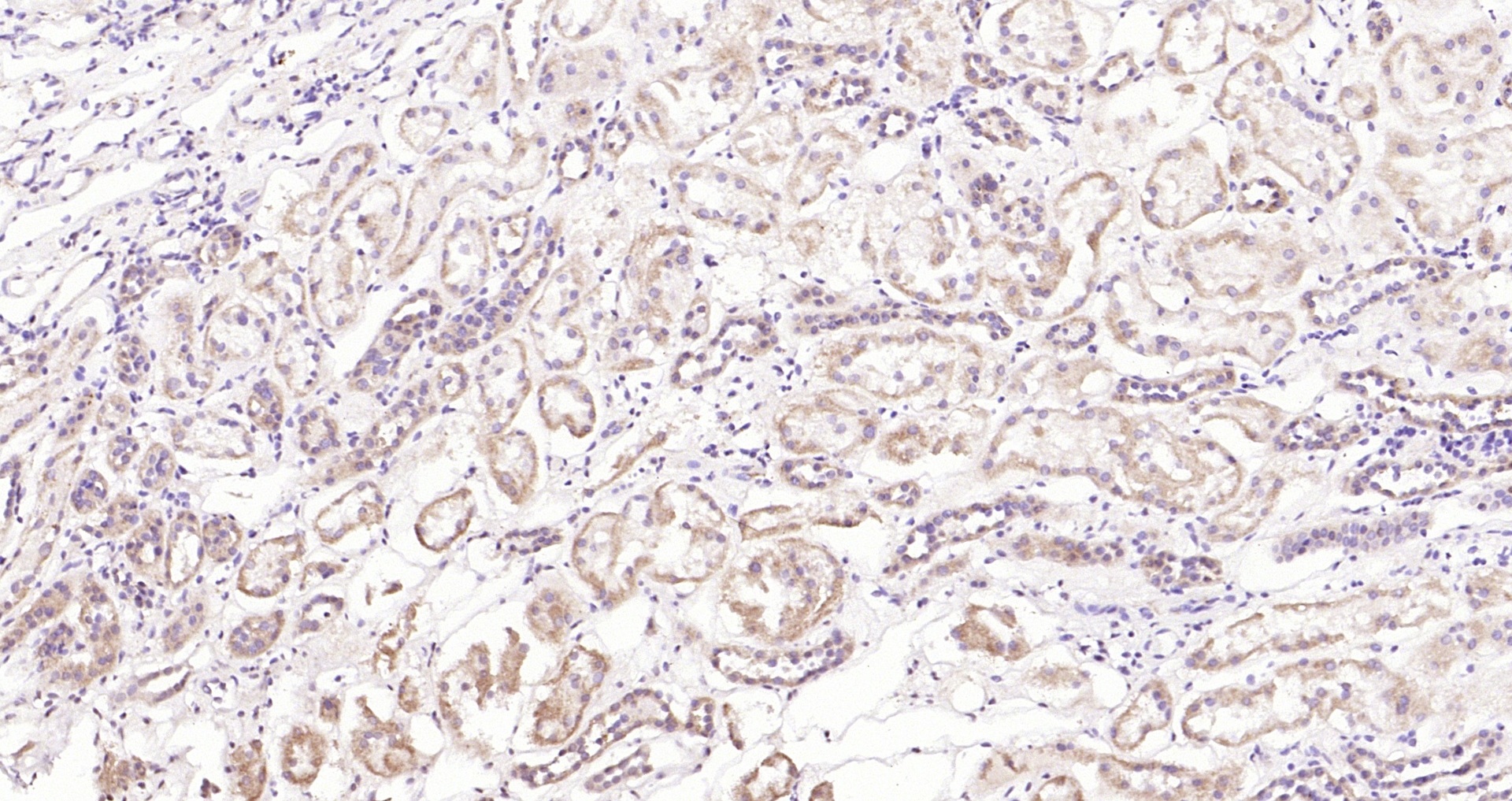 Paraformaldehyde-fixed, paraffin embedded (Human kidney); Antigen retrieval by boiling in sodium citrate buffer (pH6.0) for 15min; Block endogenous peroxidase by 3% hydrogen peroxide for 20 minutes; Blocking buffer (normal goat serum) at 37°C for 30min; Antibody incubation with (TSPO/PBR) Polyclonal Antibody, Unconjugated (bs-3674R) at 1:200 overnight at 4°C, followed by operating according to SP Kit(Rabbit) (sp-0023) instructionsand DAB staining.