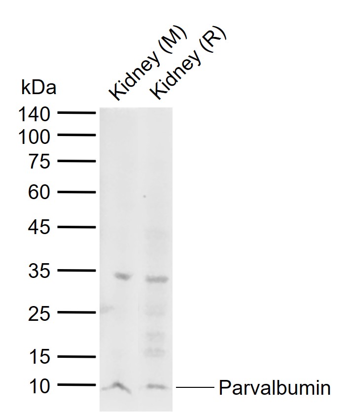 Lane 1: Mouse Kidney tissue lysates; Lane 2: Rat Kidney tissue lysates probed with Parvalbumin Polyclonal Antibody, Unconjugated (bs-1299R) at 1:1000 dilution and 4°C overnight incubation. Followed by conjugated secondary antibody incubation at 1:20000 for 60 min at 37˚C.