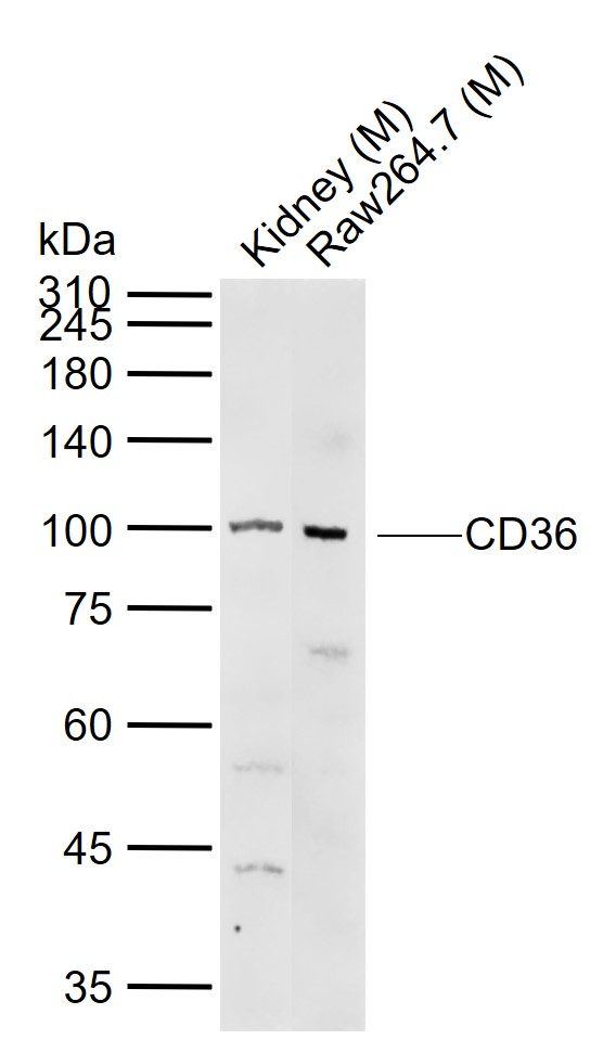 Lane 1: Mouse Kidney tissue lysates; Lane 2: Mouse Raw264.7 cell lysates probed with CD36 Polyclonal Antibody, Unconjugated (bs-1100R) at 1:1000 dilution and 4\u00b0C overnight incubation. Followed by conjugated secondary antibody incubation at 1:20000 for 60 min at 37˚C.