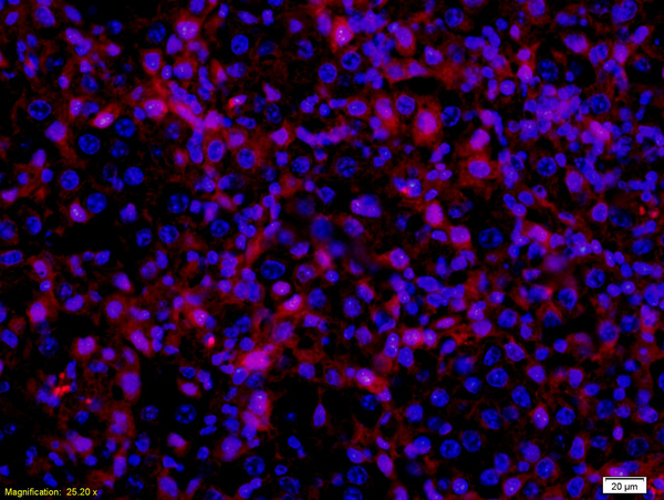 Formalin-fixed and paraffin embedded mouse melanoma labeled with Anti- MITF Polyclonal Antibody, Unconjugated (bs-1990R) at 1:200 followed by conjugation to the secondary antibody Goat Anti-Rabbit IgG, PE conjugated(bs-0295G-PE)used at 1:200 dilution for 40 minutes at 37°C and DAPI\n