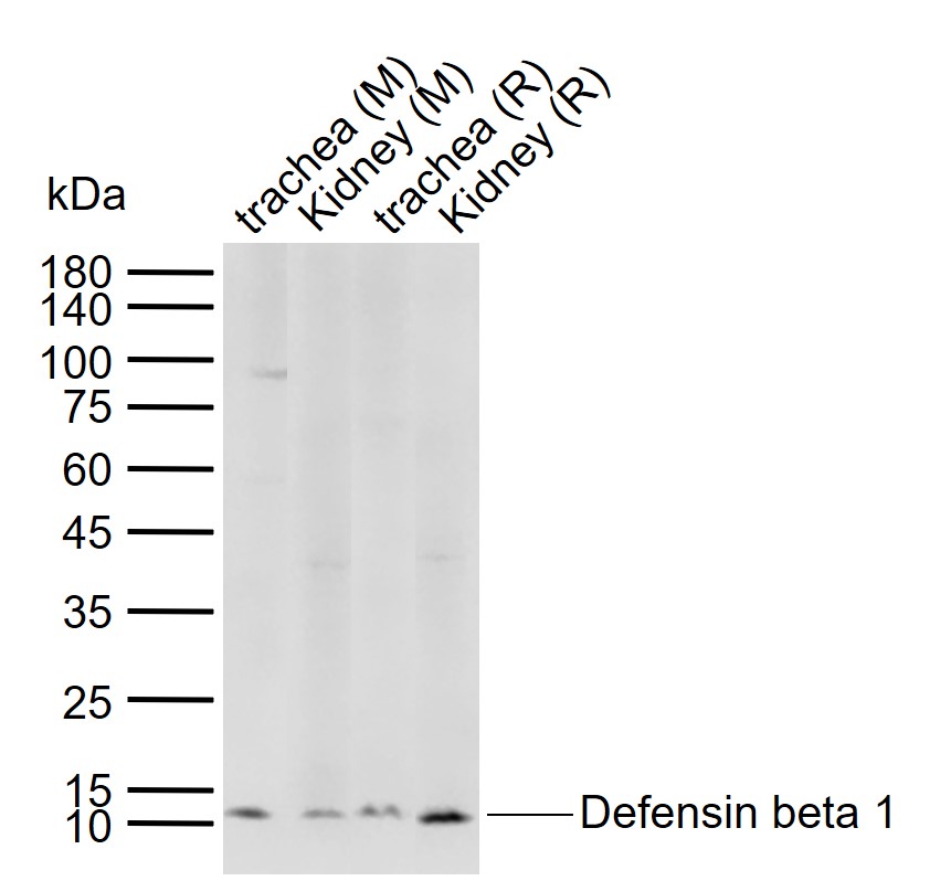 Lane 1: Mouse trachea tissue lysates; Lane 2: Mouse Kidney tissue lysates; Lane 3: Rat trachea tissue lysates; Lane 4: Rat Kidney tissue lysates probed with Defensin beta 1 Polyclonal Antibody, Unconjugated (bs-1163R) at 1:1000 dilution and 4°C overnight incubation. Followed by conjugated secondary antibody incubation at 1:20000 for 60 min at 37˚C.