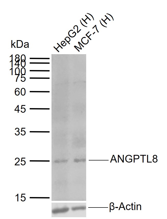 Lane 1: Human HepG2 cell lysates; Lane 2: Human MCF-7 cell lysates probed with ANGPTL8 Monoclonal Antibody, Unconjugated (bsm-49019M) at 1:1000 dilution and 4°C overnight incubation. Followed by conjugated secondary antibody incubation at 1:20000 for 60 min at 37˚C.