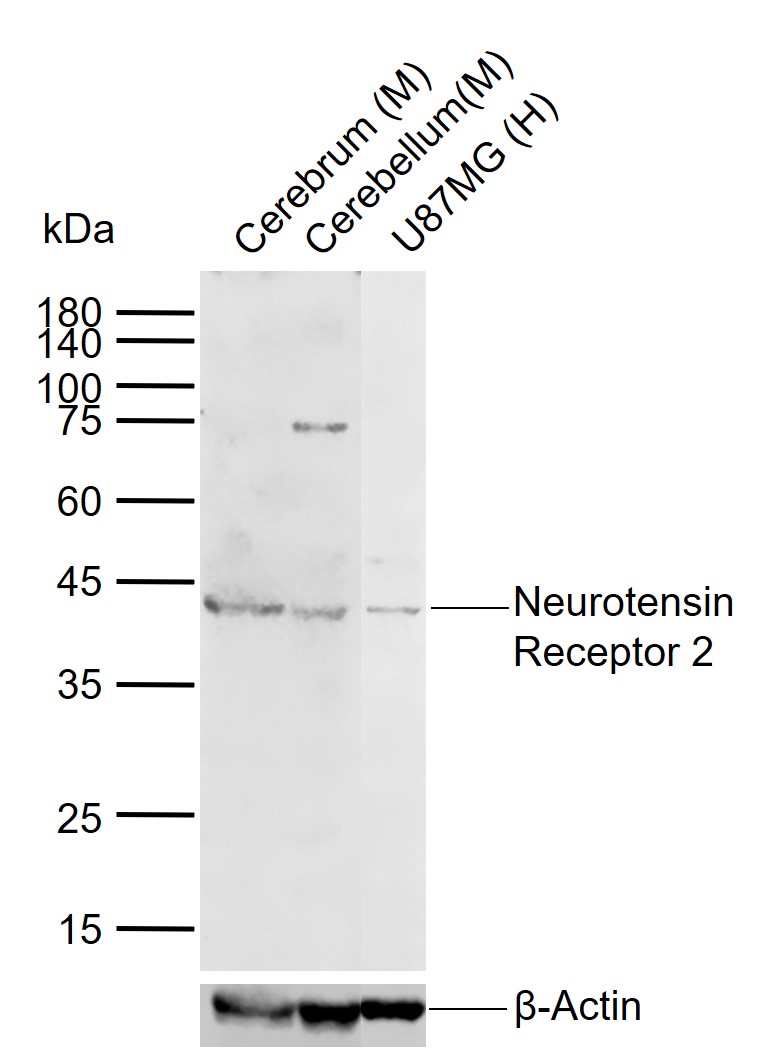 Lane 1: Mouse Cerebrum tissue lysates; Lane 2: Mouse Cerebellum tissue lysates; Lane 3: Human U87MG cell lysates probed with Neurotensin Receptor 2 Polyclonal Antibody, Unconjugated (bs-12004R) at 1:200 dilution and 4°C overnight incubation. Followed by conjugated secondary antibody incubation at 1:20000 for 60 min at 37˚C.