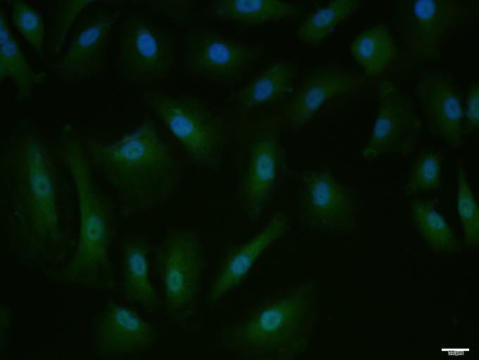 A549 cell; 4% Paraformaldehyde-fixed; Triton X-100 at room temperature for 20 min; Blocking buffer (normal goat serum, C-0005) at 37°C for 20 min; Antibody incubation with (Phospho-Mcl1 (Ser159 + Thr163)) polyclonal Antibody, Unconjugated (bs-3265R) 1:100, 90 minutes at 37°C; followed by a conjugated Goat Anti-Rabbit IgG antibody at 37°C for 90 minutes, DAPI (blue, C02-04002) was used to stain the cell nuclei.