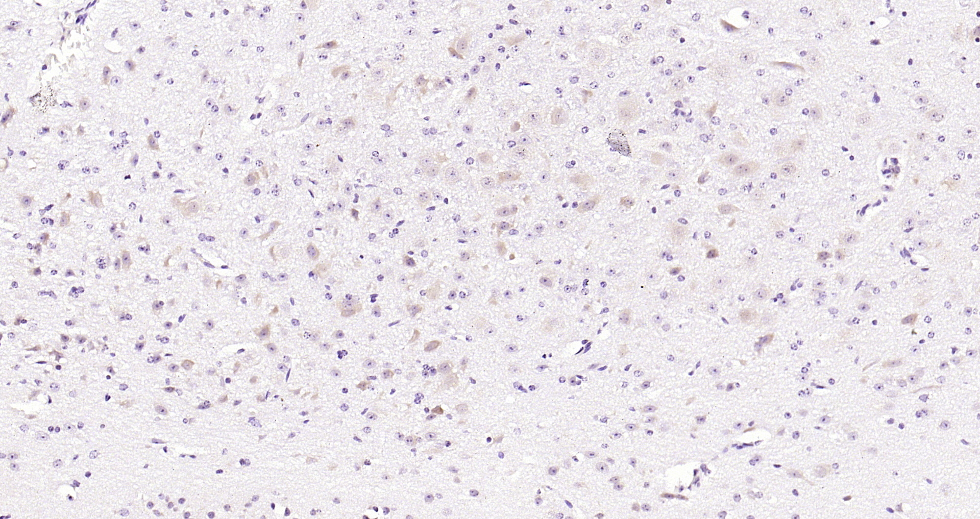 Paraformaldehyde-fixed, paraffin embedded (mouse brain); Antigen retrieval by boiling in sodium citrate buffer (pH6.0) for 15min; Block endogenous peroxidase by 3% hydrogen peroxide for 20 minutes; Blocking buffer (normal goat serum) at 37°C for 30min; Antibody incubation with (ERK4) Polyclonal Antibody, Unconjugated (bs-4131R) at 1:200 overnight at 4°C, followed by operating according to SP Kit(Rabbit) (sp-0023) instructionsand DAB staining.