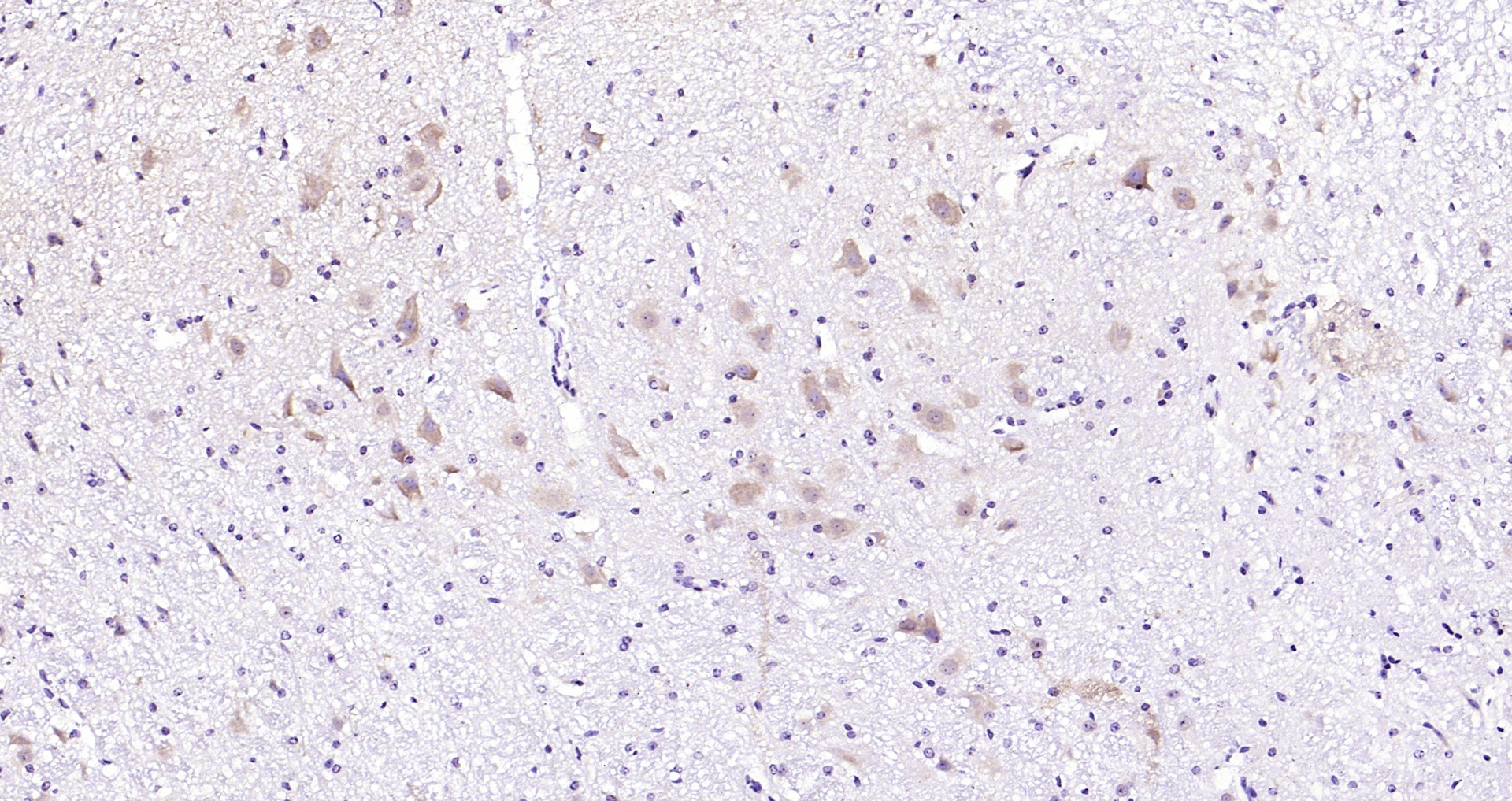 Paraformaldehyde-fixed, paraffin embedded (mouse cerebellum); Antigen retrieval by boiling in sodium citrate buffer (pH6.0) for 15min; Block endogenous peroxidase by 3% hydrogen peroxide for 20 minutes; Blocking buffer (normal goat serum) at 37°C for 30min; Antibody incubation with (ERK4) Polyclonal Antibody, Unconjugated (bs-4131R) at 1:200 overnight at 4°C, followed by operating according to SP Kit(Rabbit) (sp-0023) instructionsand DAB staining.