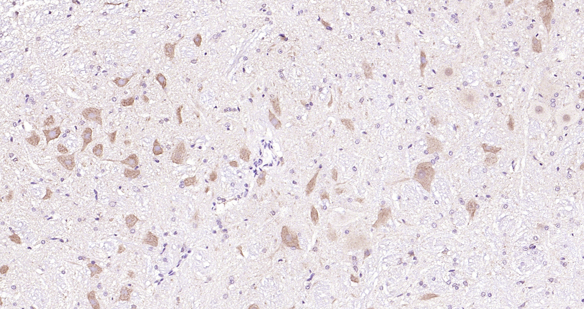 Paraformaldehyde-fixed, paraffin embedded (rat cerebellum); Antigen retrieval by boiling in sodium citrate buffer (pH6.0) for 15min; Block endogenous peroxidase by 3% hydrogen peroxide for 20 minutes; Blocking buffer (normal goat serum) at 37°C for 30min; Antibody incubation with (ERK4) Polyclonal Antibody, Unconjugated (bs-4131R) at 1:200 overnight at 4°C, followed by operating according to SP Kit(Rabbit) (sp-0023) instructionsand DAB staining.