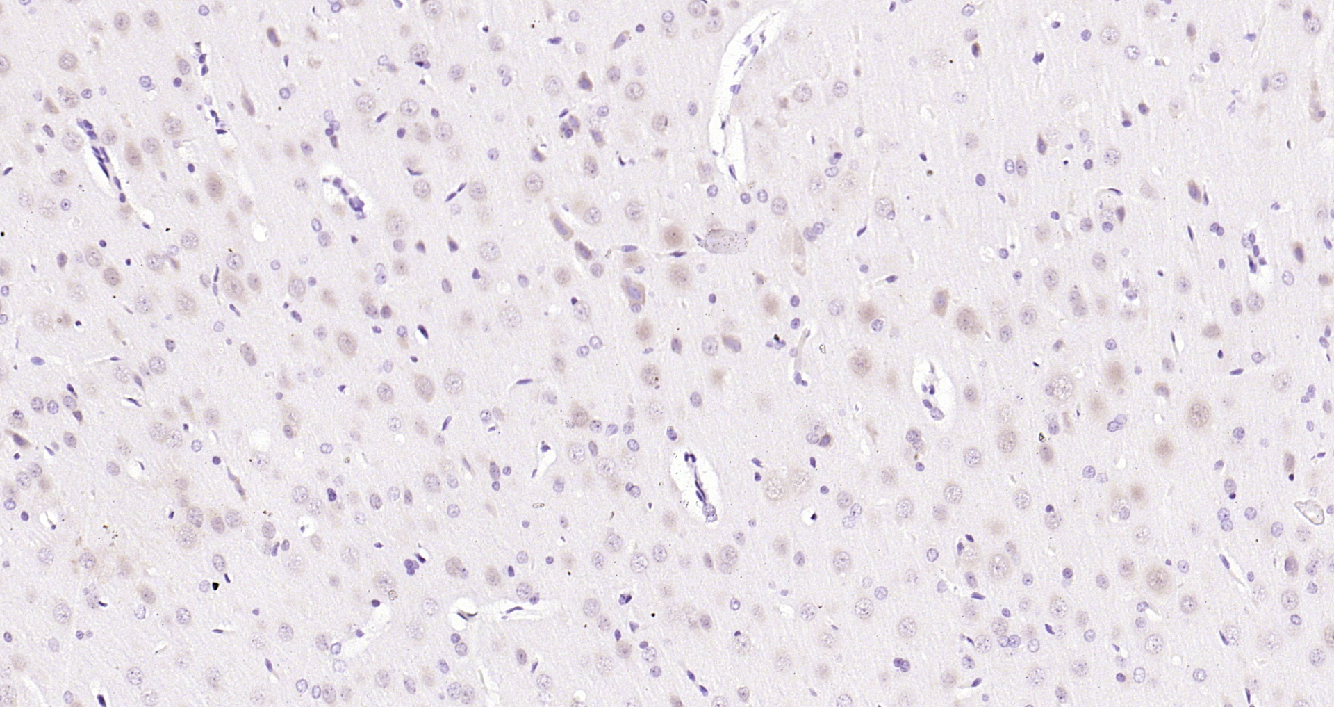 Paraformaldehyde-fixed, paraffin embedded (rat brain); Antigen retrieval by boiling in sodium citrate buffer (pH6.0) for 15min; Block endogenous peroxidase by 3% hydrogen peroxide for 20 minutes; Blocking buffer (normal goat serum) at 37°C for 30min; Antibody incubation with (ERK4) Polyclonal Antibody, Unconjugated (bs-4131R) at 1:200 overnight at 4°C, followed by operating according to SP Kit(Rabbit) (sp-0023) instructionsand DAB staining.