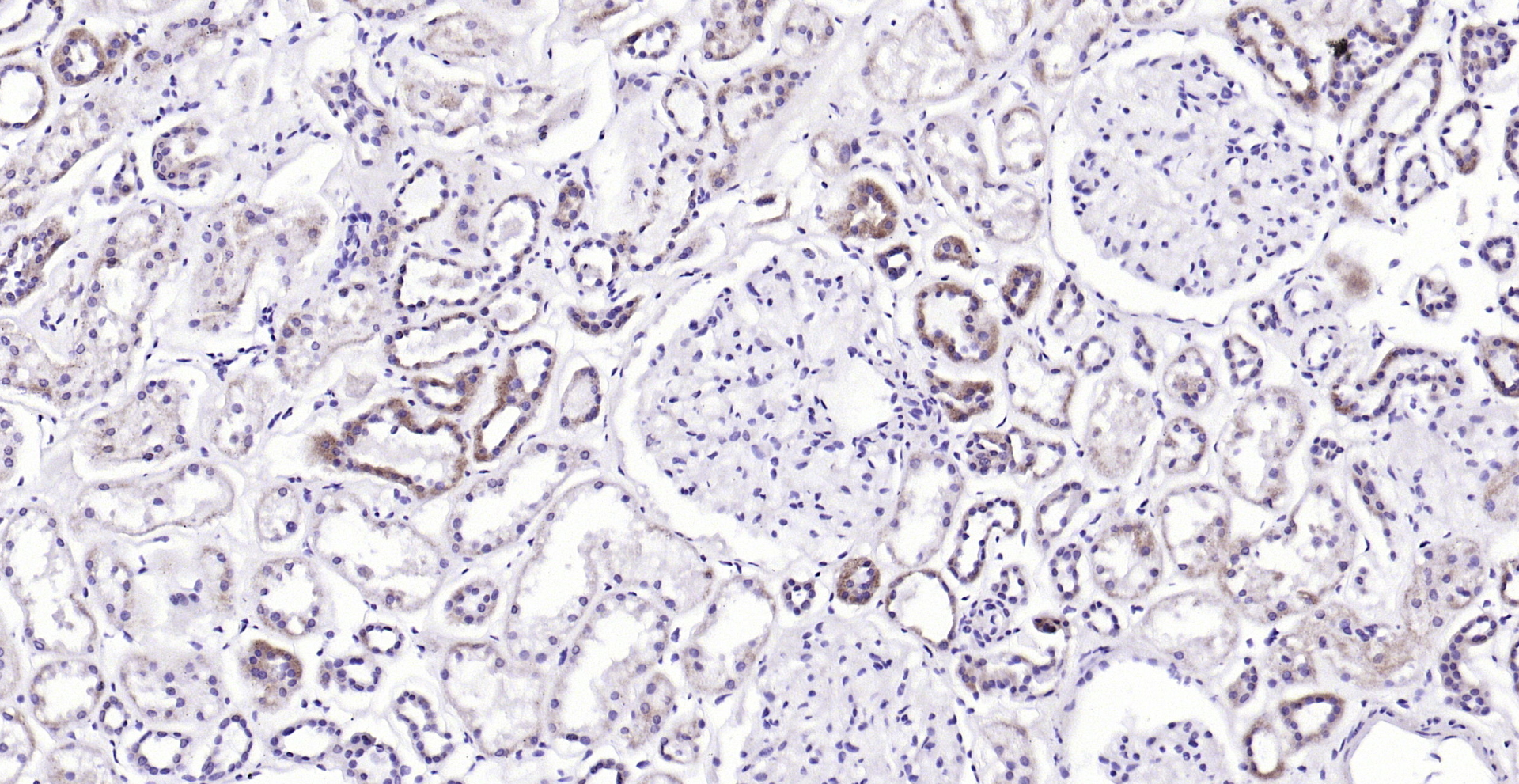 Paraformaldehyde-fixed, paraffin embedded (Human kidney); Antigen retrieval by boiling in sodium citrate buffer (pH6.0) for 15min; Block endogenous peroxidase by 3% hydrogen peroxide for 20 minutes; Blocking buffer (normal goat serum) at 37°C for 30min; Antibody incubation with (AKT1+2+3) Polyclonal Antibody, Unconjugated (bs-6951R) at 1:200 overnight at 4°C, followed by operating according to SP Kit(Rabbit) (sp-0023) instructionsand DAB staining.