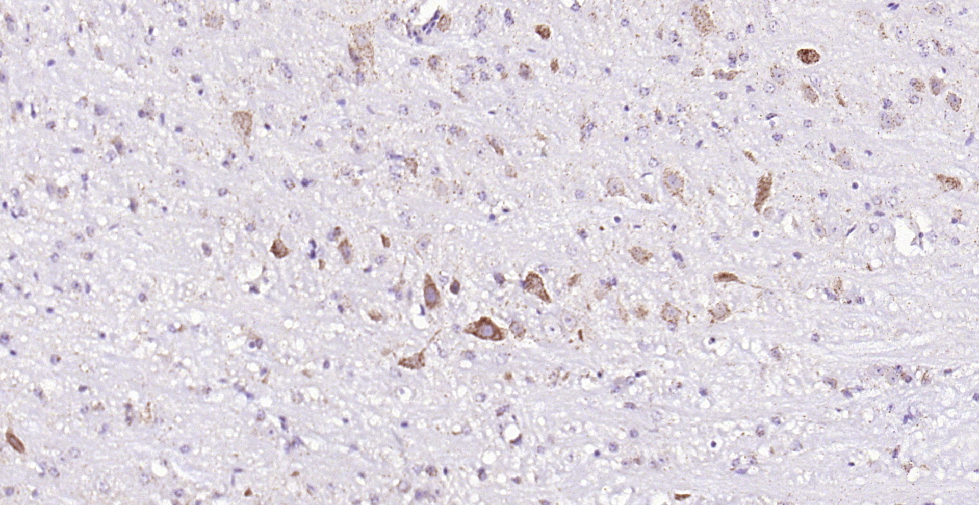 Paraformaldehyde-fixed, paraffin embedded (mouse cerebellum); Antigen retrieval by boiling in sodium citrate buffer (pH6.0) for 15min; Block endogenous peroxidase by 3% hydrogen peroxide for 20 minutes; Blocking buffer (normal goat serum) at 37°C for 30min; Antibody incubation with (Asparagine synthetase) Polyclonal Antibody, Unconjugated (bs-23431R) at 1:200 overnight at 4°C, followed by operating according to SP Kit(Rabbit) (sp-0023) instructionsand DAB staining.