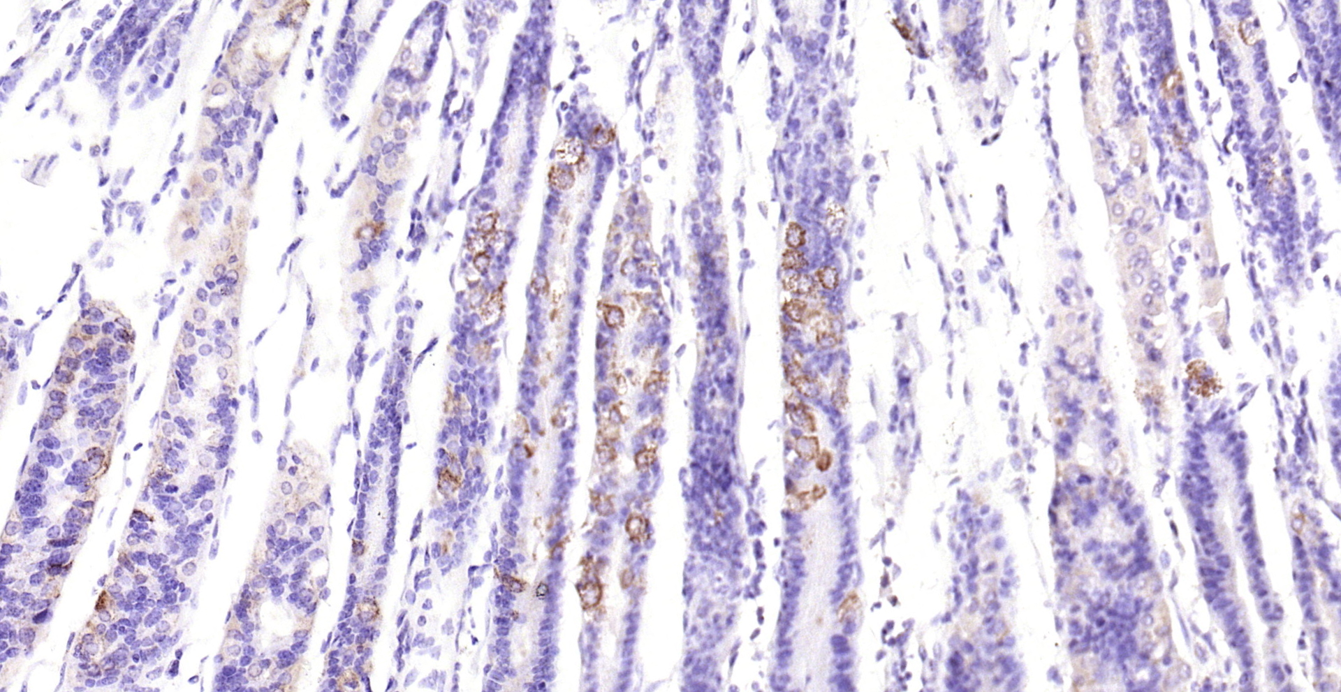 Paraformaldehyde-fixed, paraffin embedded (mouse stomach); Antigen retrieval by boiling in sodium citrate buffer (pH6.0) for 15min; Block endogenous peroxidase by 3% hydrogen peroxide for 20 minutes; Blocking buffer (normal goat serum) at 37°C for 30min; Antibody incubation with (Asparagine synthetase) Polyclonal Antibody, Unconjugated (bs-23431R) at 1:200 overnight at 4°C, followed by operating according to SP Kit(Rabbit) (sp-0023) instructionsand DAB staining.