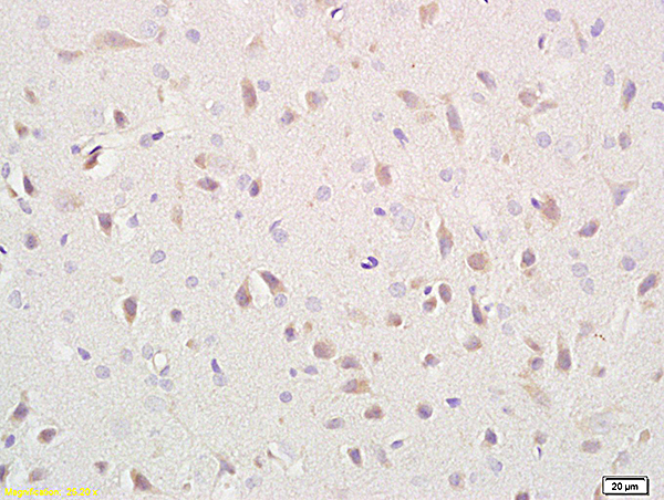 Formalin-fixed and paraffin embedded rat brain labeled with Anti- CD171/NCAM-L1 Polyclonal Antibody, Unconjugated (bs-1996R) at 1:400 followed by conjugation to the secondary antibody and DAB staining