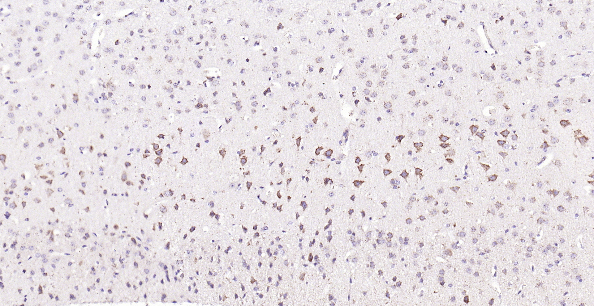 Paraformaldehyde-fixed, paraffin embedded (mouse Brian); Antigen retrieval by boiling in sodium citrate buffer (pH6.0) for 15min; Block endogenous peroxidase by 3% hydrogen peroxide for 20 minutes; Blocking buffer (normal goat serum) at 37°C for 30min; Antibody incubation with (Asparagine synthetase) Polyclonal Antibody, Unconjugated (bs-23431R) at 1:200 overnight at 4°C, followed by operating according to SP Kit(Rabbit) (sp-0023) instructionsand DAB staining.