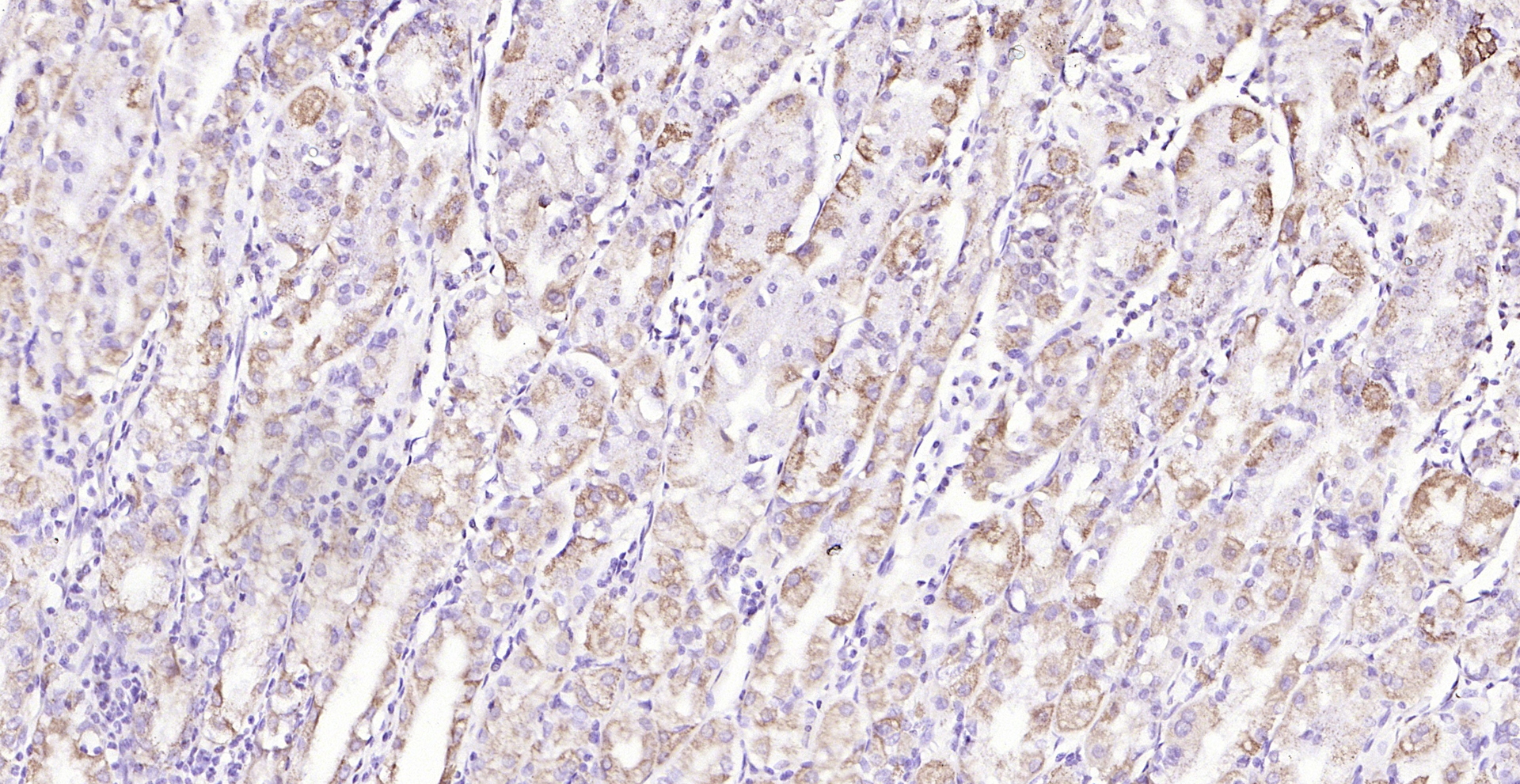 Paraformaldehyde-fixed, paraffin embedded (human stomach); Antigen retrieval by boiling in sodium citrate buffer (pH6.0) for 15min; Block endogenous peroxidase by 3% hydrogen peroxide for 20 minutes; Blocking buffer (normal goat serum) at 37°C for 30min; Antibody incubation with (Asparagine synthetase) Polyclonal Antibody, Unconjugated (bs-23431R) at 1:200 overnight at 4°C, followed by operating according to SP Kit(Rabbit) (sp-0023) instructionsand DAB staining.