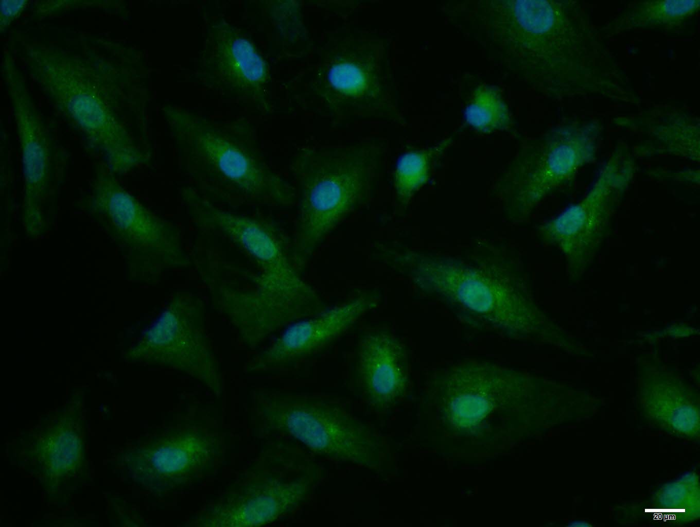 A549 cell; 4% Paraformaldehyde-fixed; Triton X-100 at room temperature for 20 min; Blocking buffer (normal goat serum, C-0005) at 37°C for 20 min; Antibody incubation with (phospho-IKK beta (Ser466)) polyclonal Antibody, Unconjugated (bs-3231R) 1:100, 90 minutes at 37°C; followed by a conjugated Goat Anti-Rabbit IgG antibody at 37°C for 90 minutes, DAPI (blue, C02-04002) was used to stain the cell nuclei.
