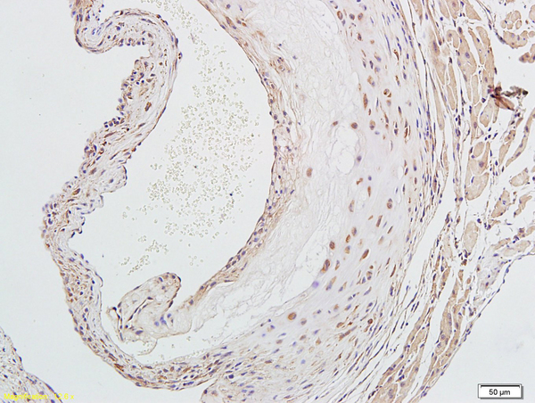 Formalin-fixed and paraffin embedded rat aorta labeled with Anti-LOX-1 Polyclonal Antibody, Unconjugated (bs-2044R) followed by conjugation to the secondary antibody and DAB staining