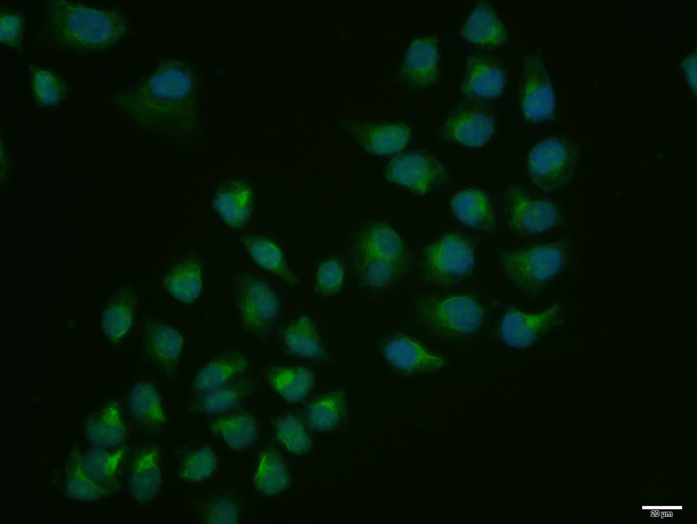 Hela cell; 4% Paraformaldehyde-fixed; Triton X-100 at room temperature for 20 min; Blocking buffer (normal goat serum, C-0005) at 37°C for 20 min; Antibody incubation with (TRAK1) polyclonal Antibody, Unconjugated (bs-5536R) 1:100, 90 minutes at 37°C; followed by a conjugated Goat Anti-Rabbit IgG antibody at 37°C for 90 minutes, DAPI (blue, C02-04002) was used to stain the cell nuclei.