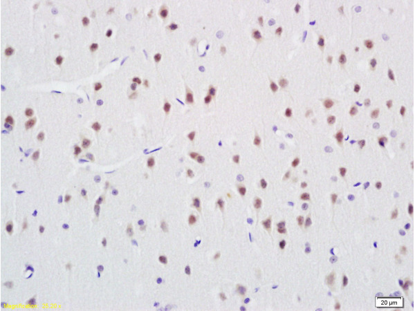 Formalin-fixed and paraffin embedded rat brain labeled with Rabbit Anti ANP32C Polyclonal Antibody, Unconjugated (bs-5927R) at 1:200 followed by conjugation to the secondary antibody and DAB staining