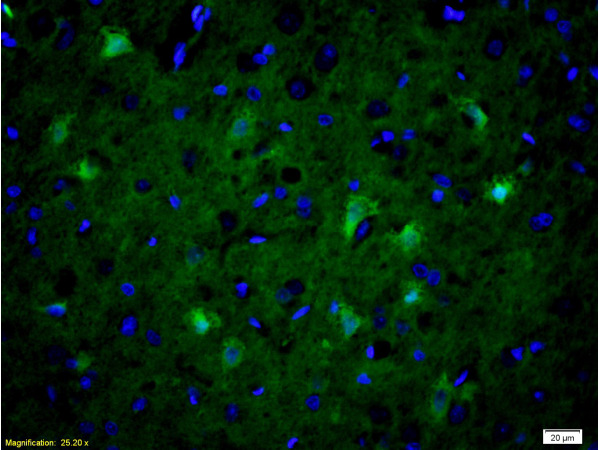 Formalin-fixed and paraffin embedded rat brain tissue labeled with Anti-NOS-2/iNOS Polyclonal Antibody, Unconjugated(bs-2072R) at 1:200 followed by conjugation to the secondary antibody Goat Anti-Rabbit IgG, FITC conjugated(bs-0295G-FITC)used at 1:200 dilution for 40 minutes at 37°C and DAPI