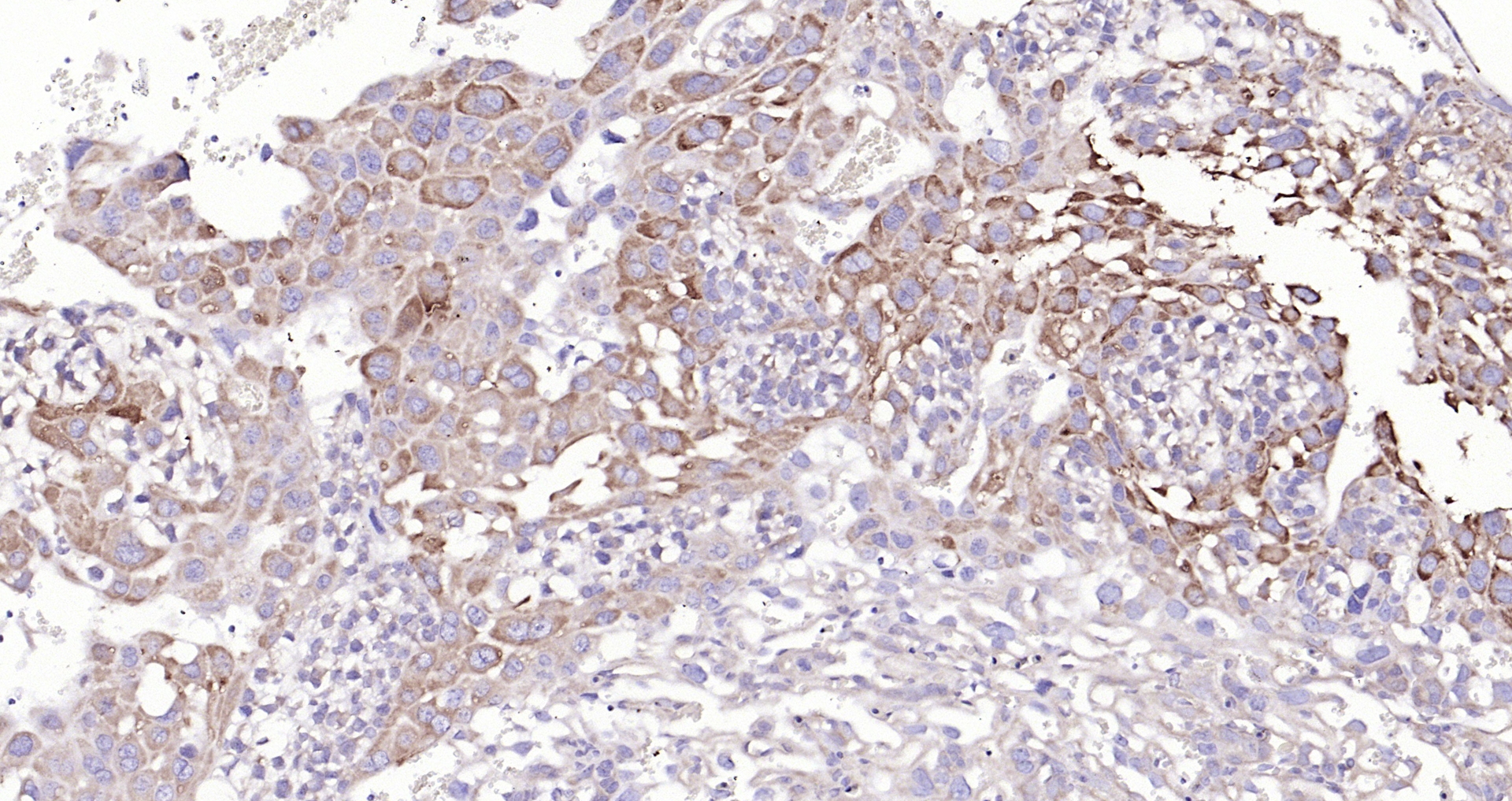 Paraformaldehyde-fixed, paraffin embedded (mouse placenta); Antigen retrieval by boiling in sodium citrate buffer (pH6.0) for 15min; Block endogenous peroxidase by 3% hydrogen peroxide for 20 minutes; Blocking buffer (normal goat serum) at 37°C for 30min; Antibody incubation with (Mesothelin) Polyclonal Antibody, Unconjugated (bs-0300R) at 1:200 overnight at 4°C, followed by operating according to SP Kit(Rabbit) (sp-0023) instructionsand DAB staining.