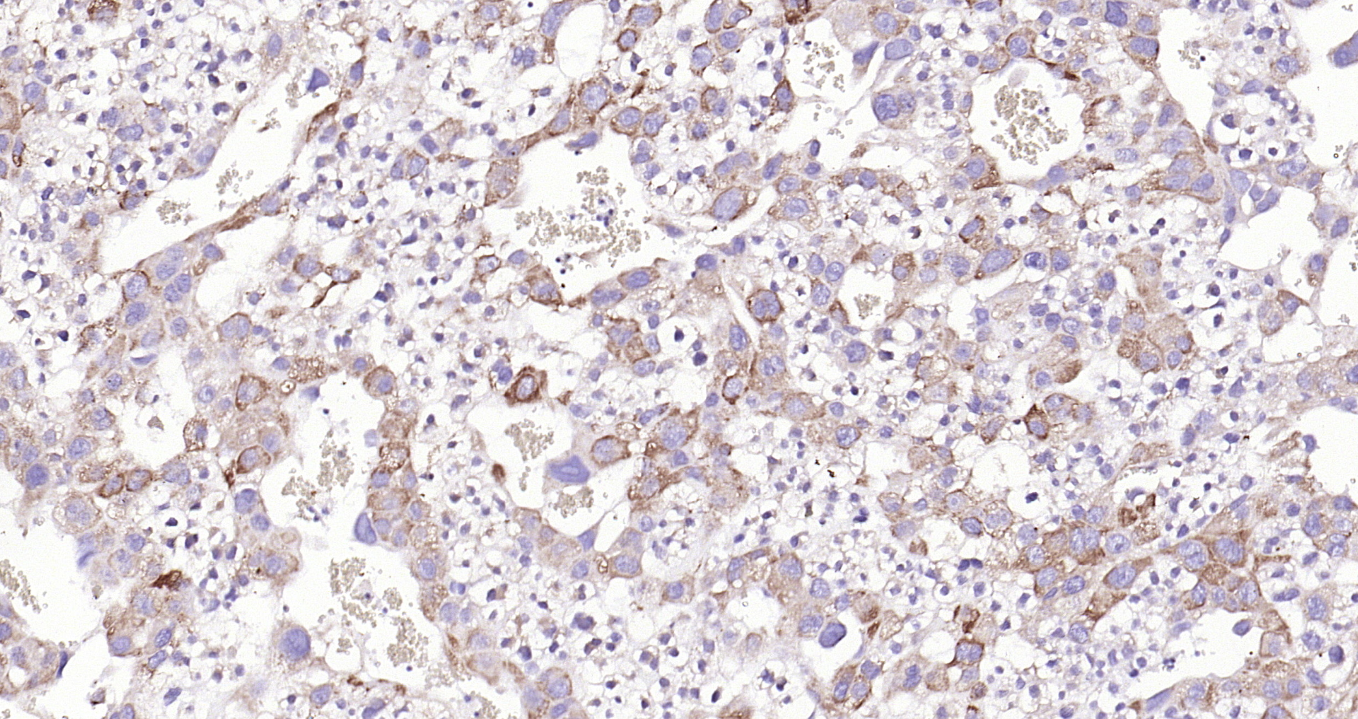 Paraformaldehyde-fixed, paraffin embedded (rat placenta); Antigen retrieval by boiling in sodium citrate buffer (pH6.0) for 15min; Block endogenous peroxidase by 3% hydrogen peroxide for 20 minutes; Blocking buffer (normal goat serum) at 37°C for 30min; Antibody incubation with (Mesothelin) Polyclonal Antibody, Unconjugated (bs-0300R) at 1:200 overnight at 4°C, followed by operating according to SP Kit(Rabbit) (sp-0023) instructionsand DAB staining.