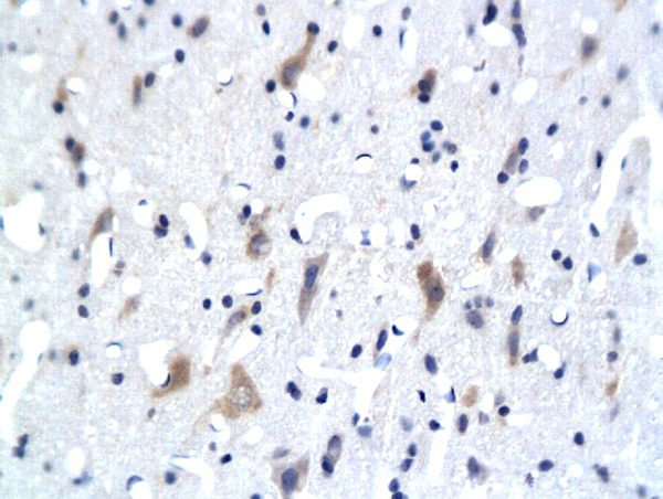 Formalin-fixed and paraffin embedded rat brain labeled with Anti- 5-HTR3Polyclonal Antibody, Unconjugated(bs-2126R) followed by conjugation to the secondary antibody and DAB staining Formalin-fixed and paraffin embedded rat brain labeled with Anti- 5-HTR3Polyclonal Antibody, Unconjugated(bs-2126R) followed by conjugation to the secondary antibody and DAB staining