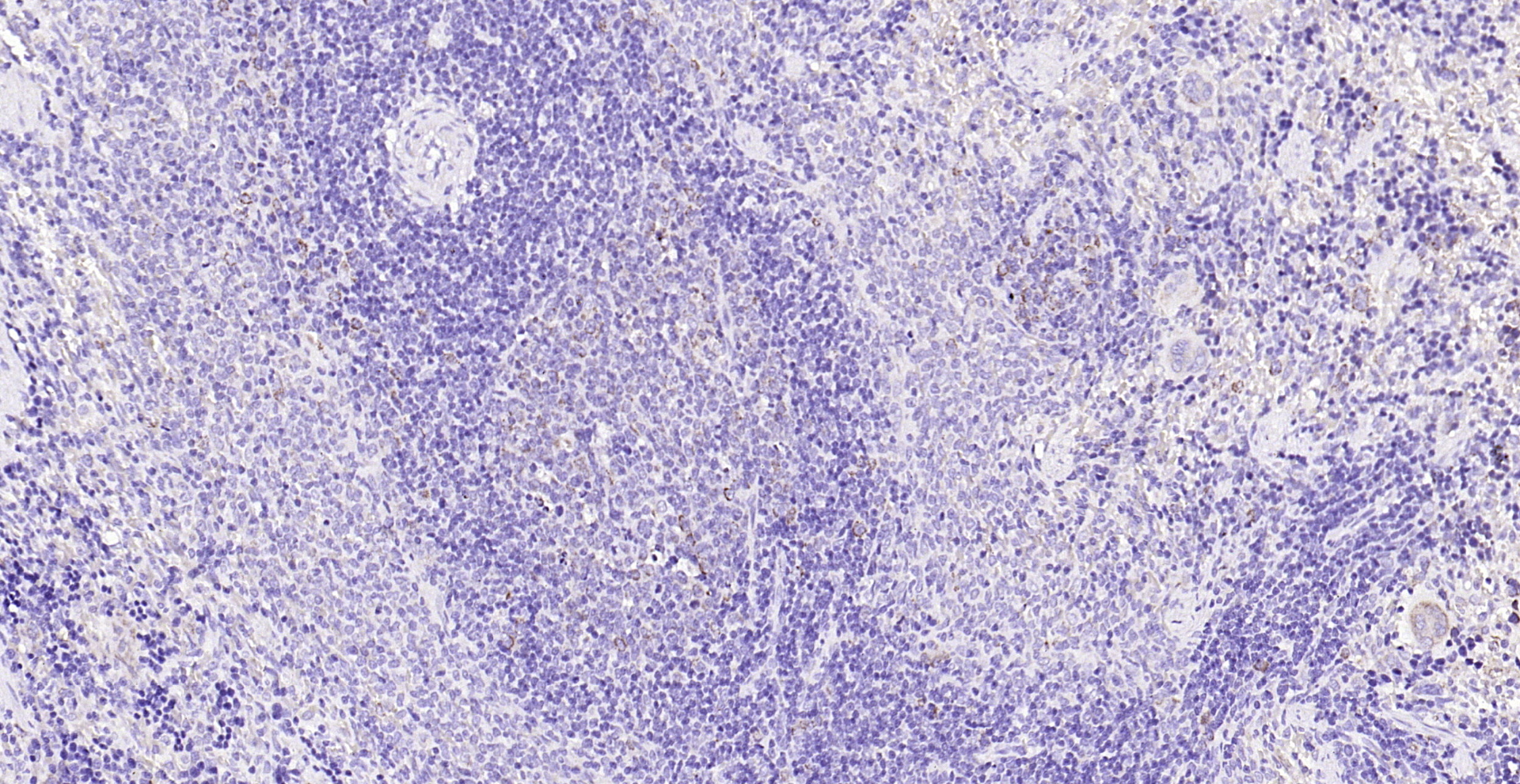 Paraformaldehyde-fixed, paraffin embedded (rat spleen ）; Antigen retrieval by boiling in sodium citrate buffer (pH6.0) for 15min; Block endogenous peroxidase by 3% hydrogen peroxide for 20 minutes; Blocking buffer (normal goat serum) at 37°C for 30min; Antibody incubation with (SCD1) Polyclonal Antibody, Unconjugated (bs-3787R) at 1:200 overnight at 4°C, followed by operating according to SP Kit(Rabbit) (sp-0023) instructionsand DAB staining.