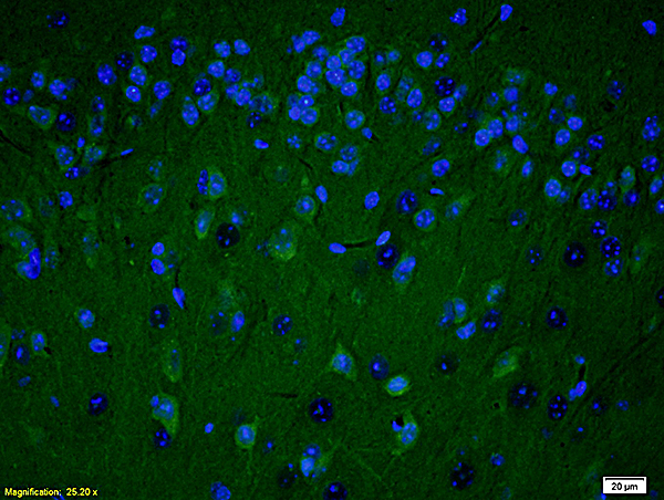 Formalin-fixed and paraffin embedded rat brain labeled with Anti PARP (N-Terminus) Polyclonal Antibody, Unconjugated(bs-2138R) at 1:200 followed by conjugation to the secondary antibody Goat Anti-Rabbit IgG, FITC conjugated(bs-0295G-FITC)used at 1:200 dilution for 40 minutes at 37°C and DAPI