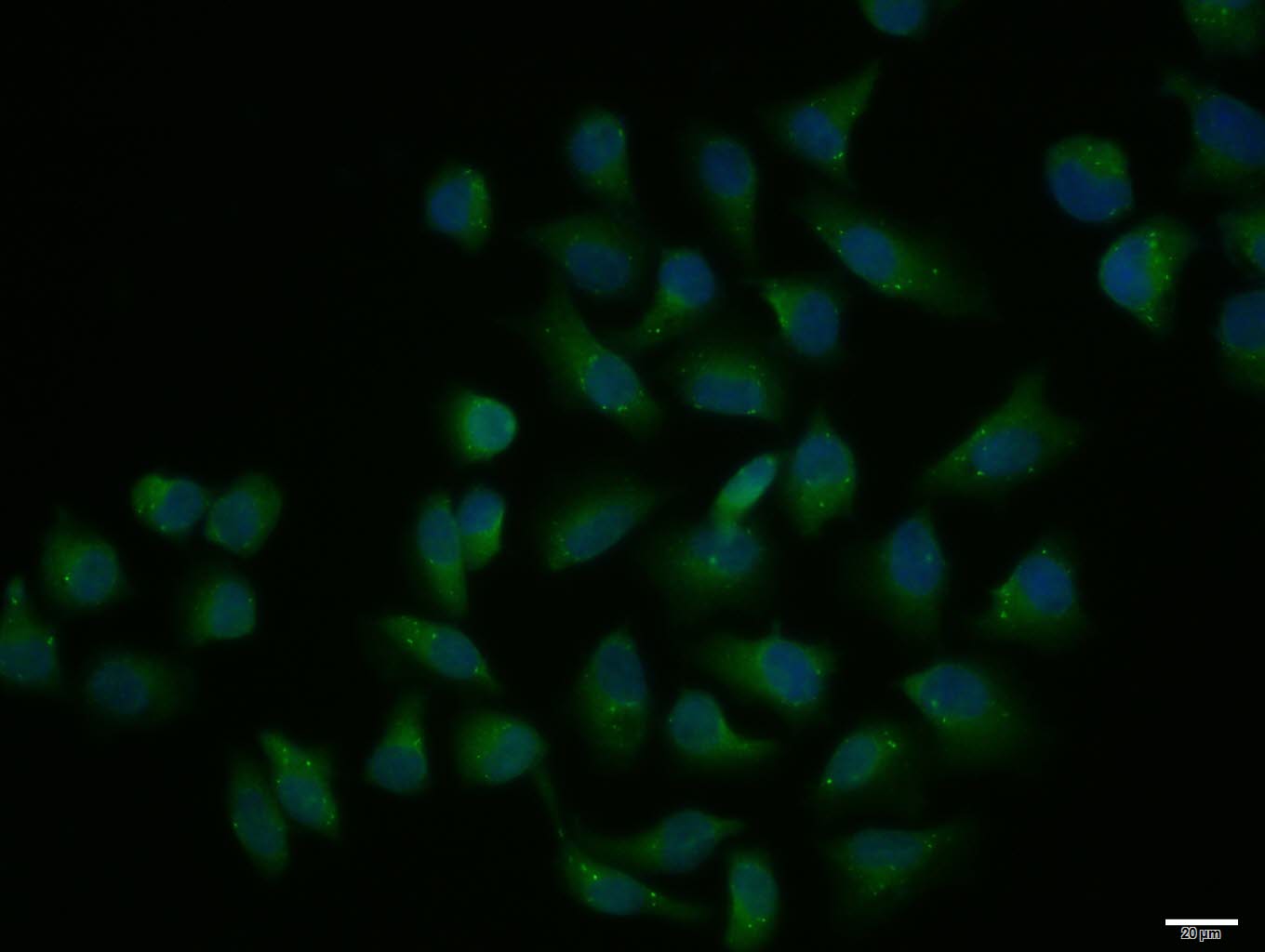 Hela cell; 4% Paraformaldehyde-fixed; Triton X-100 at room temperature for 20 min; Blocking buffer (normal goat serum, C-0005) at 37°C for 20 min; Antibody incubation with (GIP) polyclonal Antibody, Unconjugated (bs-0098R) 1:100, 90 minutes at 37°C; followed by a conjugated Goat Anti-Rabbit IgG antibody at 37°C for 90 minutes, DAPI (blue, C02-04002) was used to stain the cell nuclei.