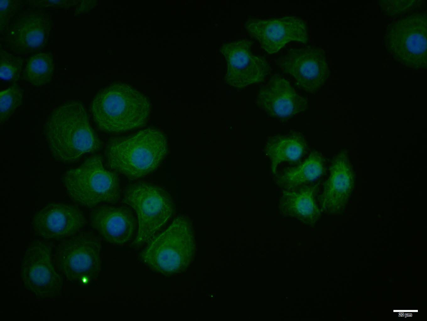 HepG2 cell; 4% Paraformaldehyde-fixed; Triton X-100 at room temperature for 20 min; Blocking buffer (normal goat serum, C-0005) at 37\u00b0C for 20 min; Antibody incubation with (PDCD1LG2) polyclonal Antibody, Unconjugated (bs-1868R) 1:100, 90 minutes at 37\u00b0C; followed by a conjugated Goat Anti-Rabbit IgG antibody at 37\u00b0C for 90 minutes, DAPI (blue, C02-04002) was used to stain the cell nuclei.
