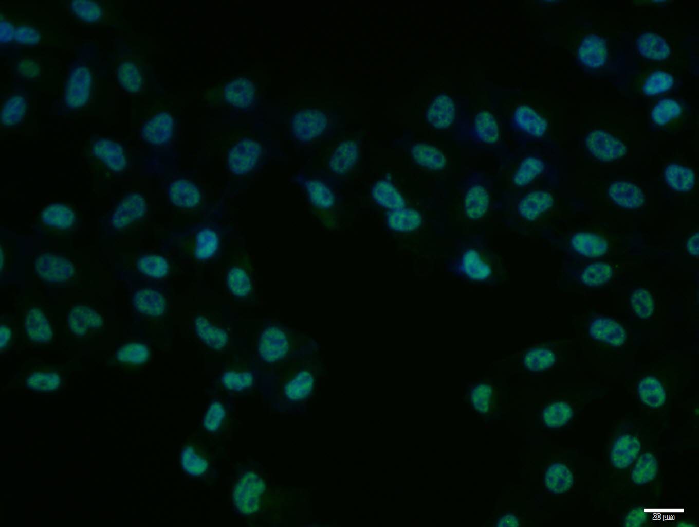 Hela cell; 4% Paraformaldehyde-fixed; Triton X-100 at room temperature for 20 min; Blocking buffer (normal goat serum, C-0005) at 37°C for 20 min; Antibody incubation with (PKM2) polyclonal Antibody, Unconjugated (bs-0102M) 1:100, 90 minutes at 37°C; followed by a conjugated Goat Anti-Mouse IgG antibody at 37°C for 90 minutes, DAPI (blue, C02-04002) was used to stain the cell nuclei.